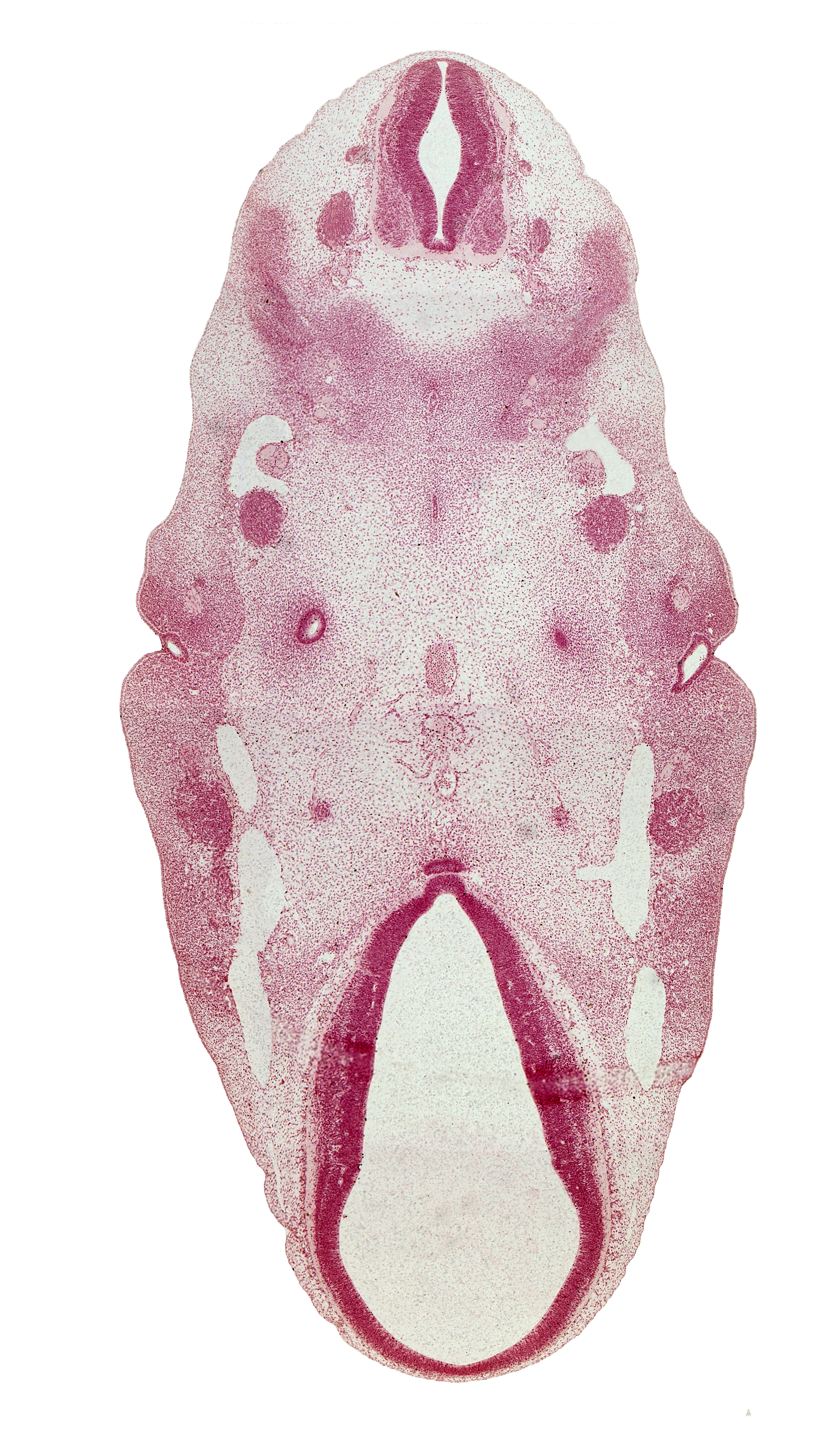 C-1 / C-2 interganglion region, abducens nerve (CN VI), adenohypophysial pouch, basilar artery, caudal edge of cochlear duct, cephalic end of sympathetic trunk, cervical myotome, dorsal thalamus, hypothalamus, junction of dorsal sulcus and sulcus limitans, junction of maxillary and primary head veins, lateral rectus premuscle mass, neurohypophyseal bud, notochord, ophthalmic nerve (CN V₁), parachordal condensation, pharyngeal arch 1, pharyngeal arch 2, pharyngeal groove 1, pharyngeal pouch 1, roof plate, spinal accessory nerve (CN XI), sulcus limitans, ventral thalamus, vertebral artery