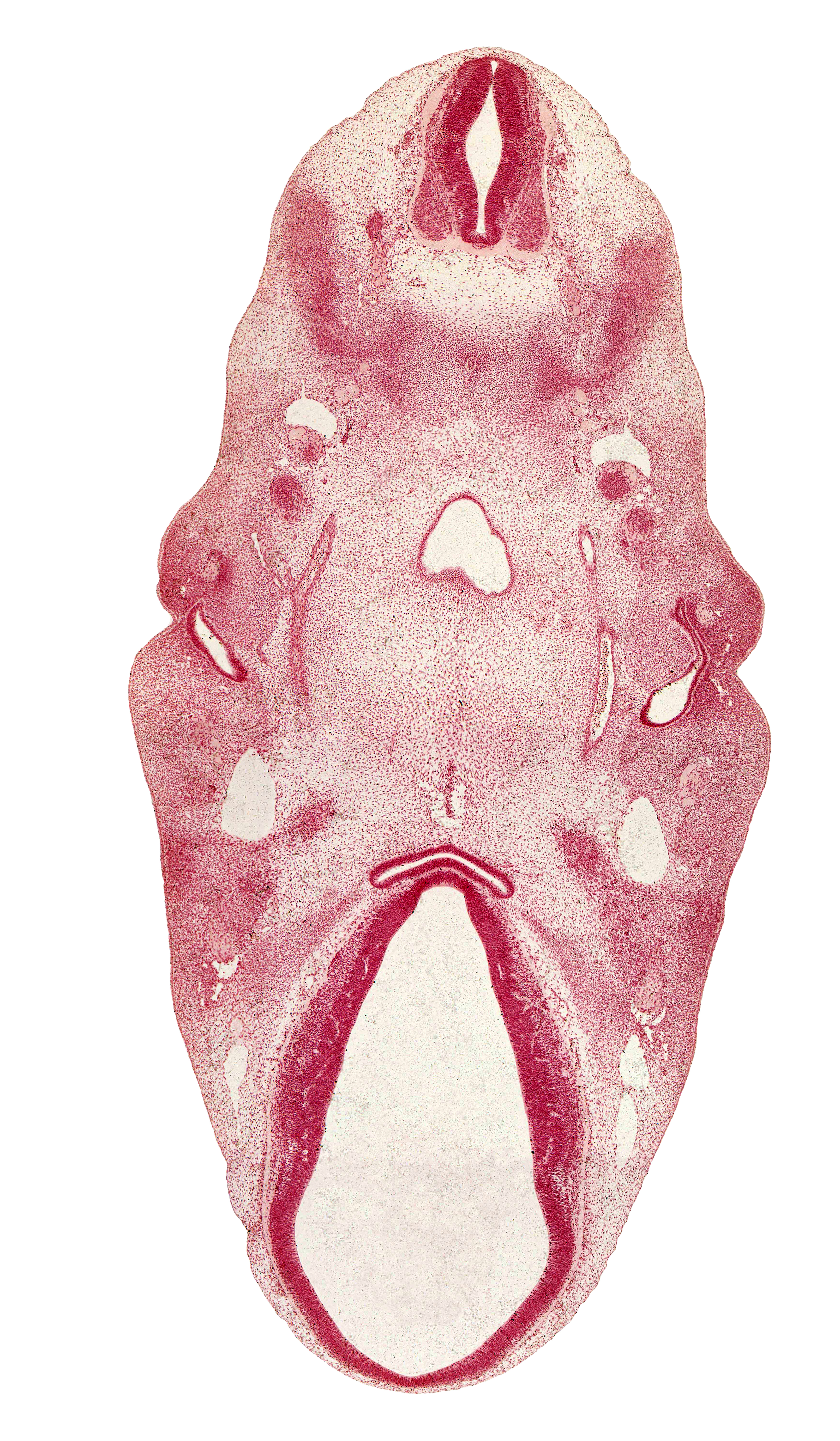 C-1 spinal nerve, adenohypophysial pouch, alar plate(s), anterior dural venous plexus, auricular hillock, basal plate, cephalic edge of C-2 spinal ganglion, cephalic edge of tongue, cephalic end of notochord, diencephalon, extra-ocular premuscle mass, floor plate, glossopharyngeal nerve (CN IX), internal carotid artery, mandibular nerve (CN V₃), myotome, neurohypophyseal bud, notochord, pharynx, posterior communicating artery, precardinal vein, roof plate, sulcus limitans, terminal branches of maxillary nerve (CN V₂), vagus nerve (CN X), vascular plexus