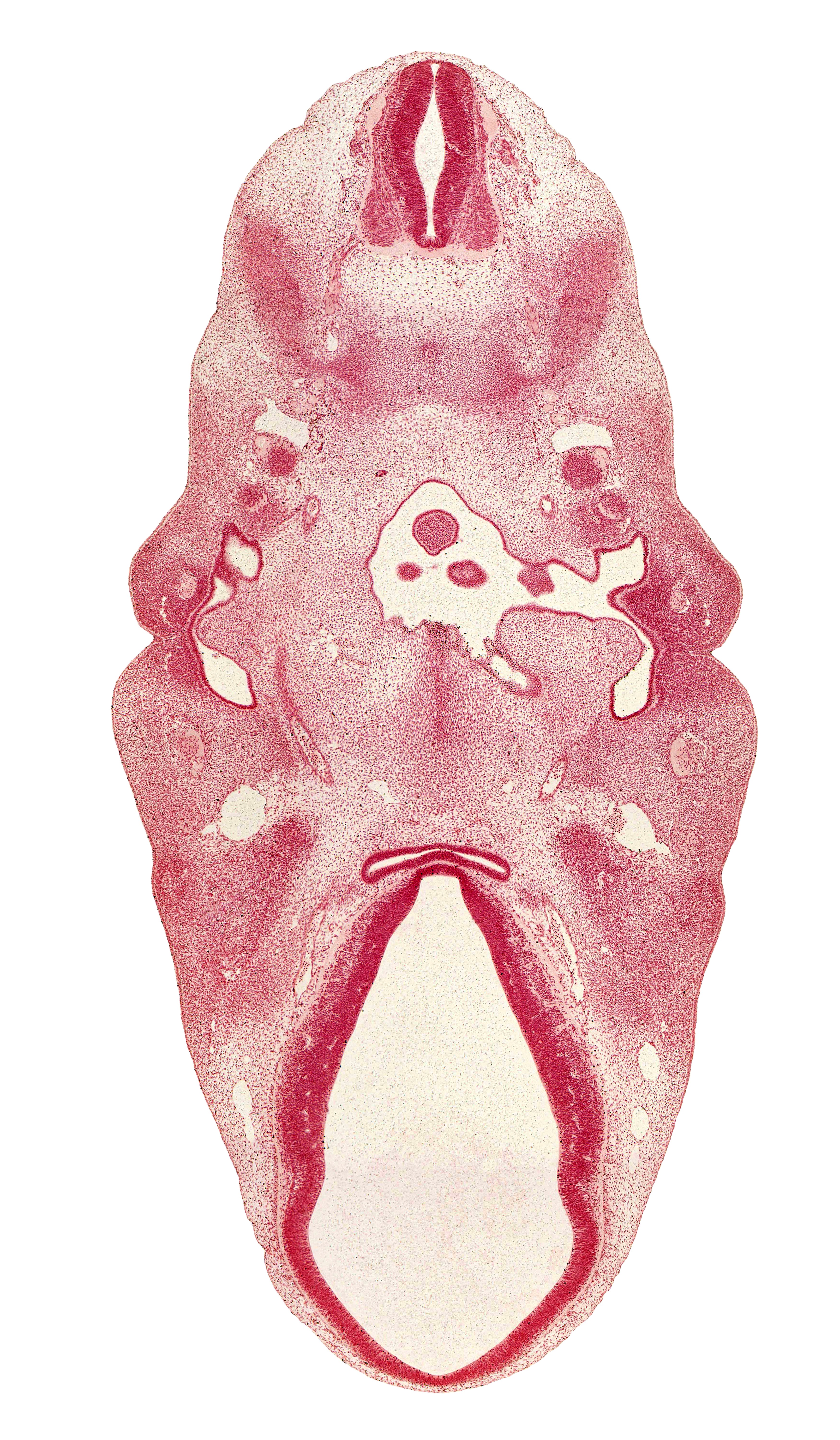 C-2 spinal ganglion, adenohypophysial pouch, anterior dural venous plexus, dorsal root(s), dorsal sulcus, facial nerve (CN VII), glossopharyngeal nerve (CN IX), hypopharyngeal eminence of tongue, inferior ganglion of vagus nerve (CN X), intermediate zone, internal carotid artery, junction of internal carotid and posterior communicating arteries, mandibular nerve (CN V₃), marginal zone, middle sulcus, myotome, neurohypophyseal bud, pharyngeal groove 1, pharynx, precardinal vein, sclerotome, spinal accessory nerve (CN XI), tuberculum impar of tongue, ventral (hypothalamic) sulcus, ventricular zone