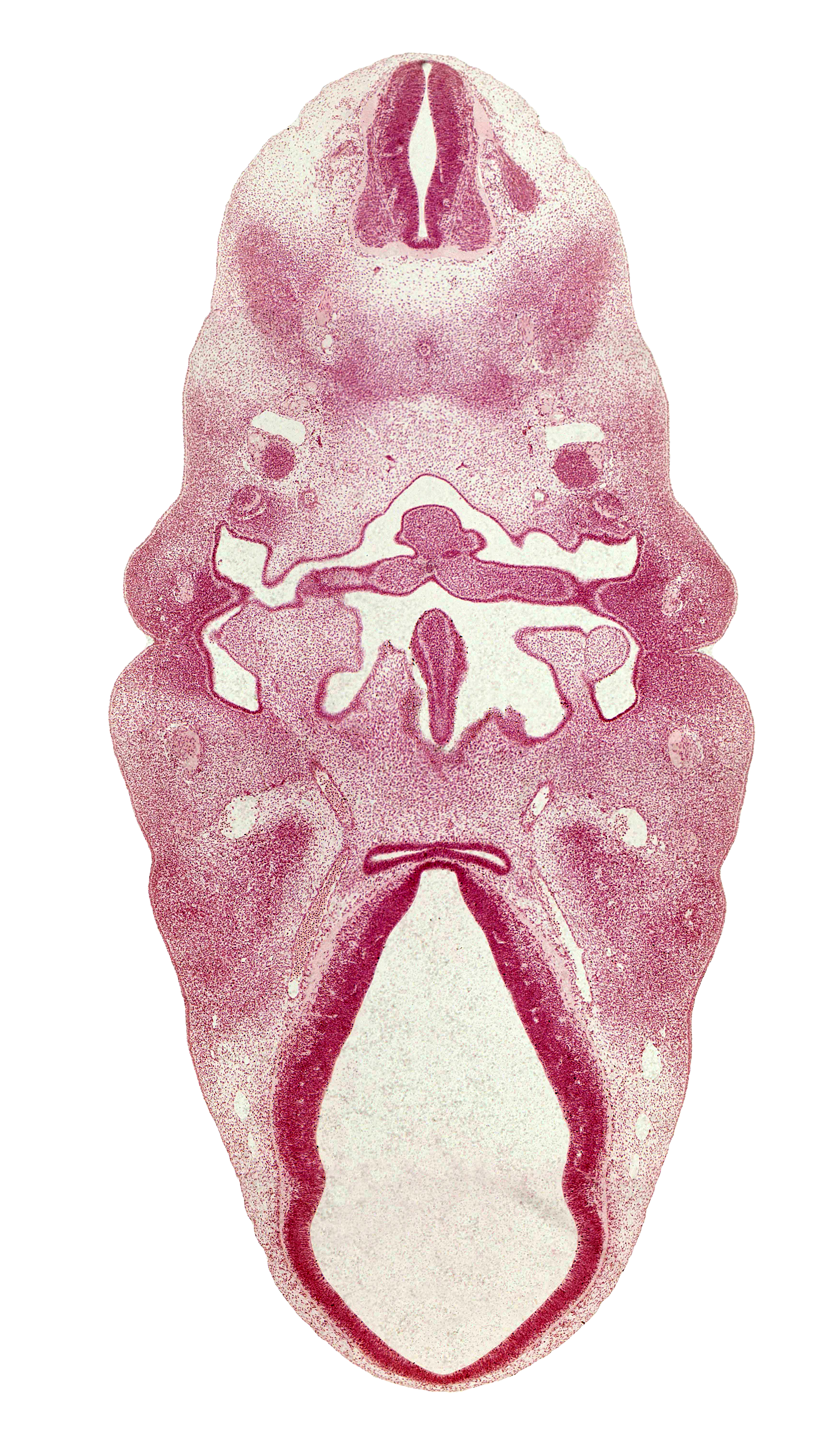 C-2 spinal ganglion, adenohypophysial pouch, central canal, copula of tongue, diencephalon, dorsal thalamus, edge of optic cup, epiglottis, facial nerve (CN VII), foramen cecum of tongue, glossopharyngeal nerve (CN IX), hypoglossal nerve (CN XII), hypothalamus, inferior ganglion of vagus nerve (CN X), lateral lingual swelling of tongue, mandibular nerve (CN V₃), maxillary vein, neurohypophyseal bud, notochord, oronasal cavity, pharyngeal groove 1, pharyngeal pouch 2, pharynx, primordium of lateral palatine process, third ventricle, tuberculum impar of tongue, ventral thalamus