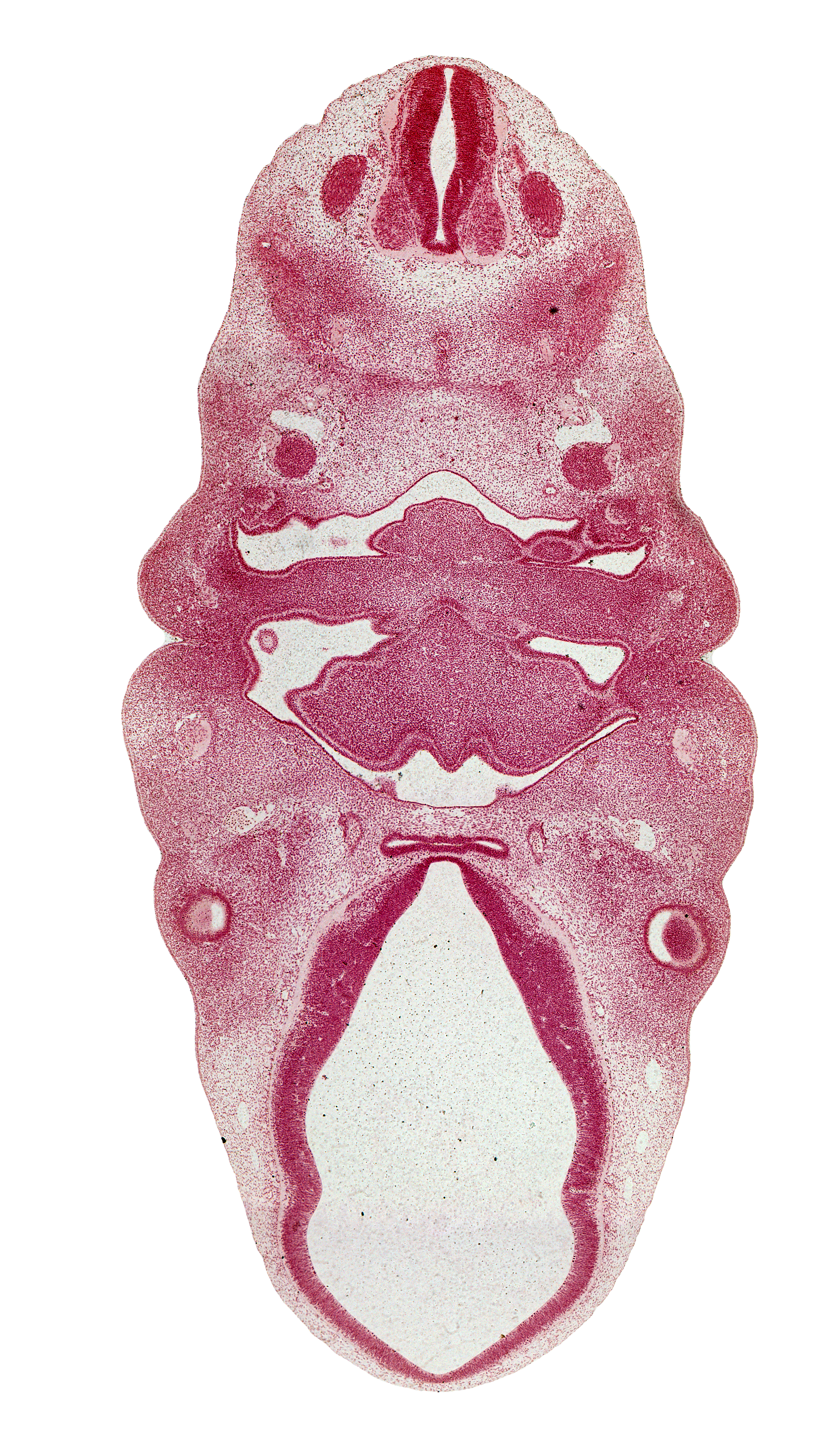 C-2 spinal ganglion, adenohypophysial pouch, anterior dural venous plexus, chorda tympani nerve, edge of optic stalk (CN II), facial nerve (CN VII), hypoglossal nerve (CN XII), internal carotid artery, lateral lingual swelling of tongue, mandibular nerve (CN V₃), marginal ridge, maxillary vein, neurohypophyseal bud, notochord, oronasal cavity, pharyngeal pouch 2, pharynx, pigmented layer of retina, sympathetic trunk, third ventricle, thyroglossal duct, tuberculum impar