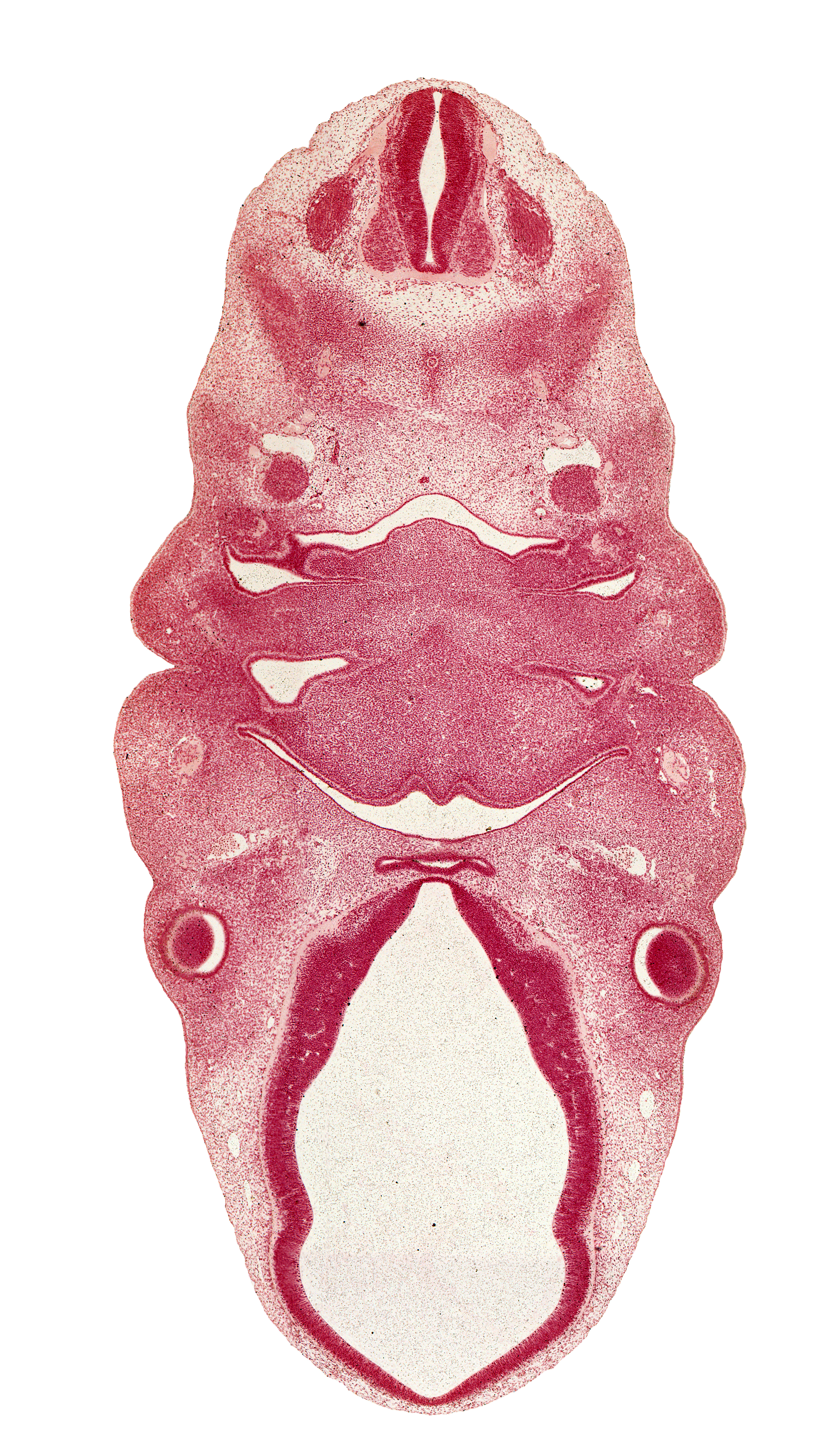 C-2 spinal ganglion, alar plate(s), basal plate, dorsal fasciculus, edge of optic stalk (CN II), floor plate, glossopharyngeal nerve (CN IX), hypoglossal nerve (CN XII), hypopharyngeal eminence of tongue, infundibular recess, internal carotid artery, intraretinal space (optic vesicle cavity), mandibular nerve (CN V₃), marginal zone of diencephalon, marginal zone of retina, opening of adenohypophysial pouch, oronasal cavity, pharyngeal pouch 2, precartilage condensation of pharyngeal arch 2, premuscle mass of tongue, resorbing thyroglossal duct, roof plate, sympathetic trunk