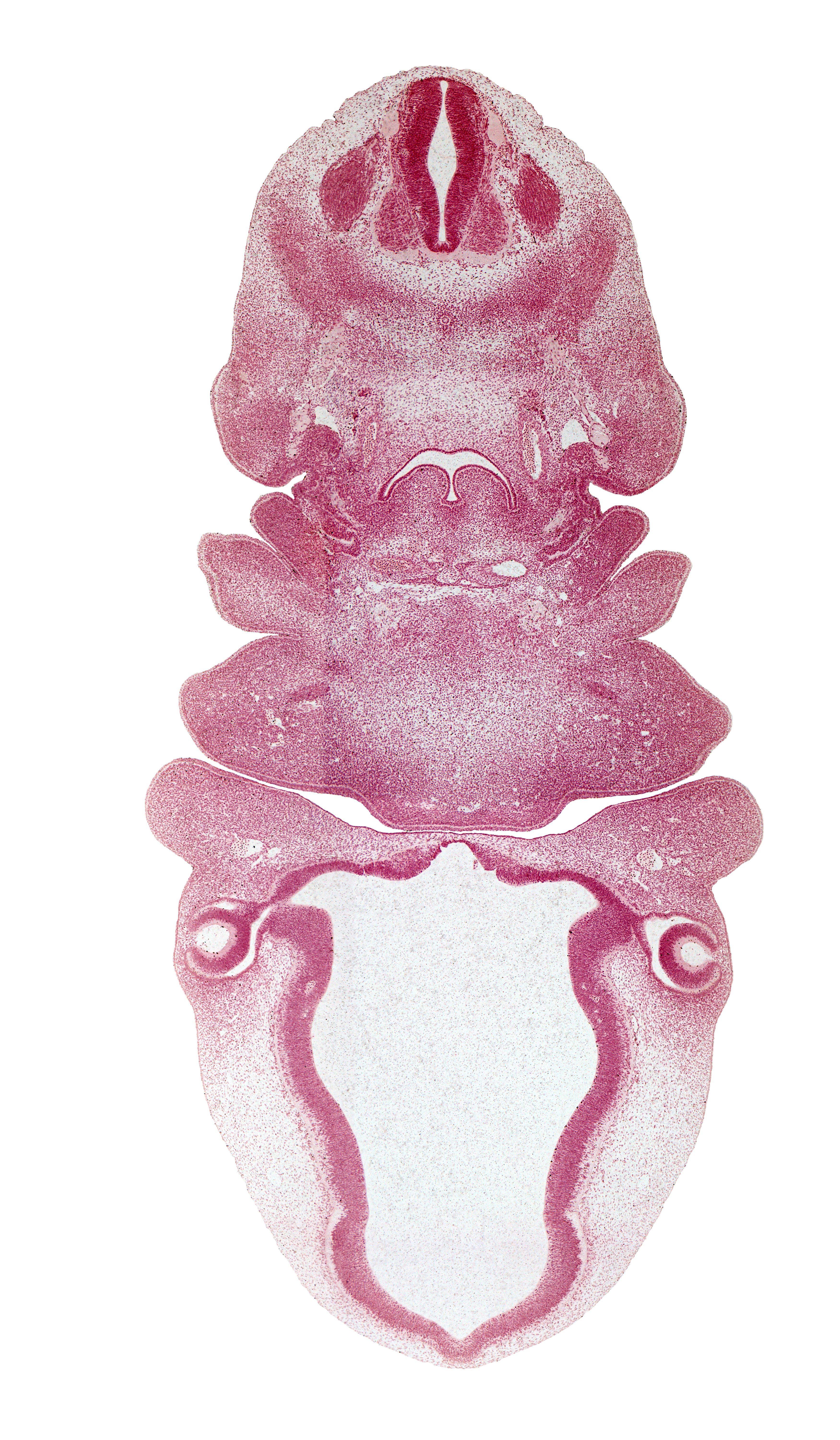 C-3 spinal ganglion, aortic arch 4, bilobed thyroid gland, central canal, cervical fold, cervical sinus, diencephalon, edge of cerebral vesicle(s), edge of optic stalk (CN II), epithalamus, horn of aortic sac, hypoglossal nerve (CN XII), intraretinal space (optic vesicle cavity), laryngeal condensation, lateral lingual swelling of tongue, lateral part of thyroid gland, myotome, optic chiasma (chiasmatic plate), optic cup cavity, oronasal cavity, pineal bud, precardinal vein, primordial meninx, spinal accessory nerve (CN XI), sternocleidomastoid / trapezius premuscle mass, third ventricle