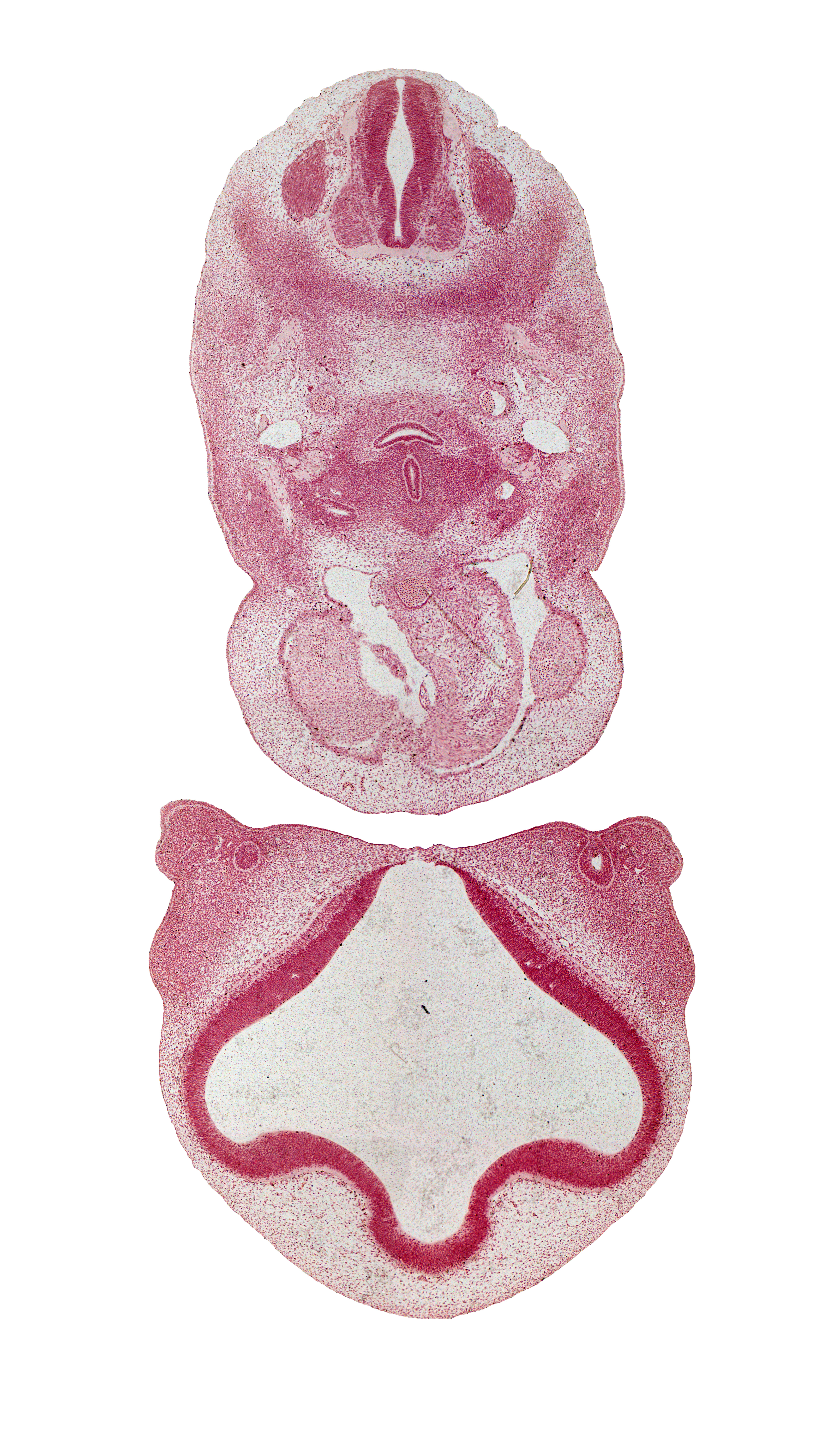 C-4 spinal ganglion, anterior cerebral artery, aortic arch 6, aorticopulmonary septum, ascending aorta, dorsal aorta, edge of truncus arteriosus, esophageal condensation, esophagus, interventricular foramen, lateral ventricle, left atrium, maxillary prominence of pharyngeal arch 1, medial nasal prominence(s), nasal fin, pre-optic area, precardinal vein, third ventricle, torus hemisphericus, trachea, tracheal condensation, vagus nerve (CN X)