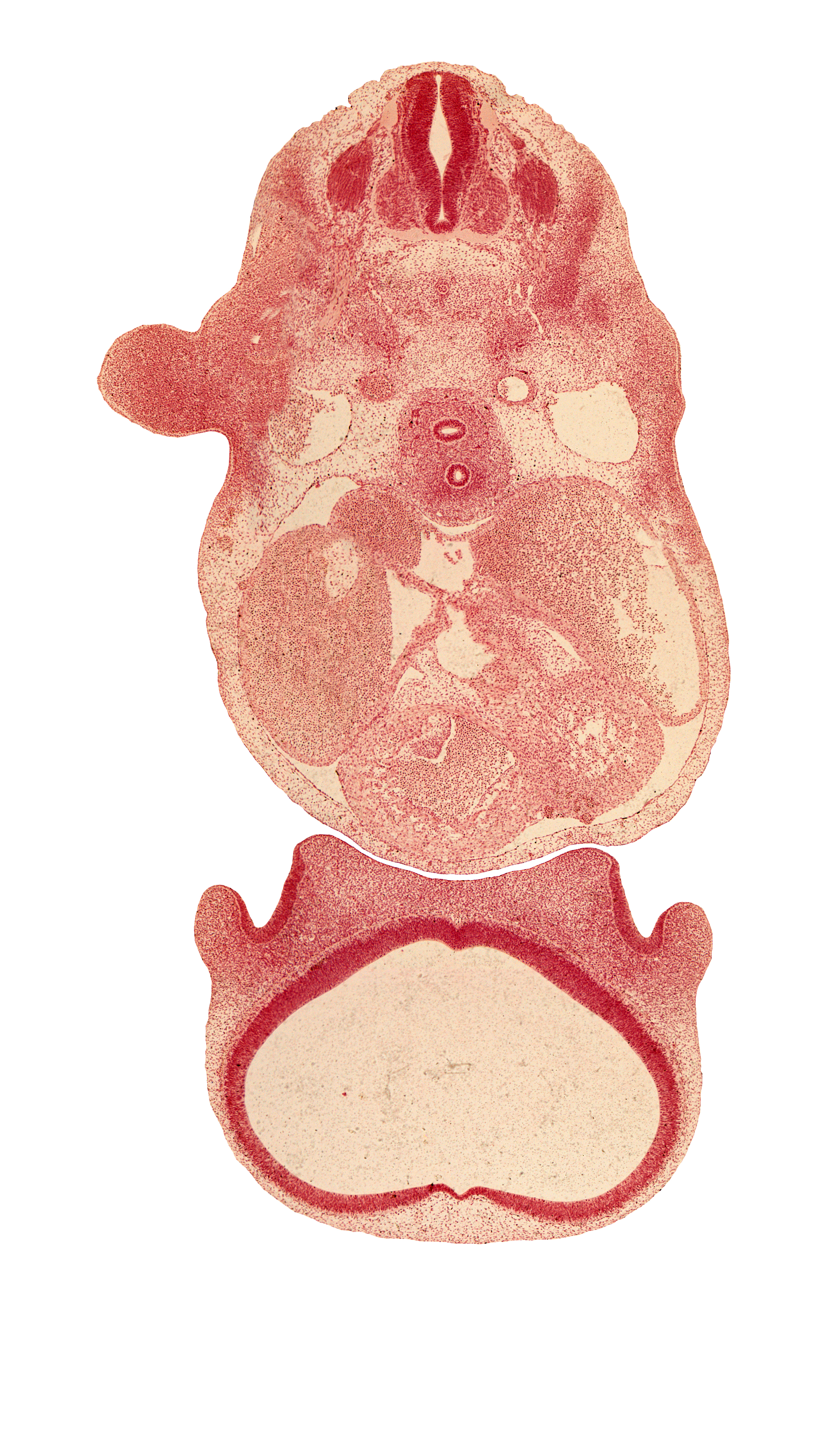 C-5 spinal ganglion, aortic vestibule of left ventricle, dorsal aorta, infundibulum of right ventricle, interventricular foramen, lateral ventricle, musculi pectinati, nasal disc (olfactory placode), precardinal vein, region of olfactory filia (CN I), right atrium, secondary interatrial septum (septum secundum), sinus venosus, third ventricle, vagus nerve (CN X)