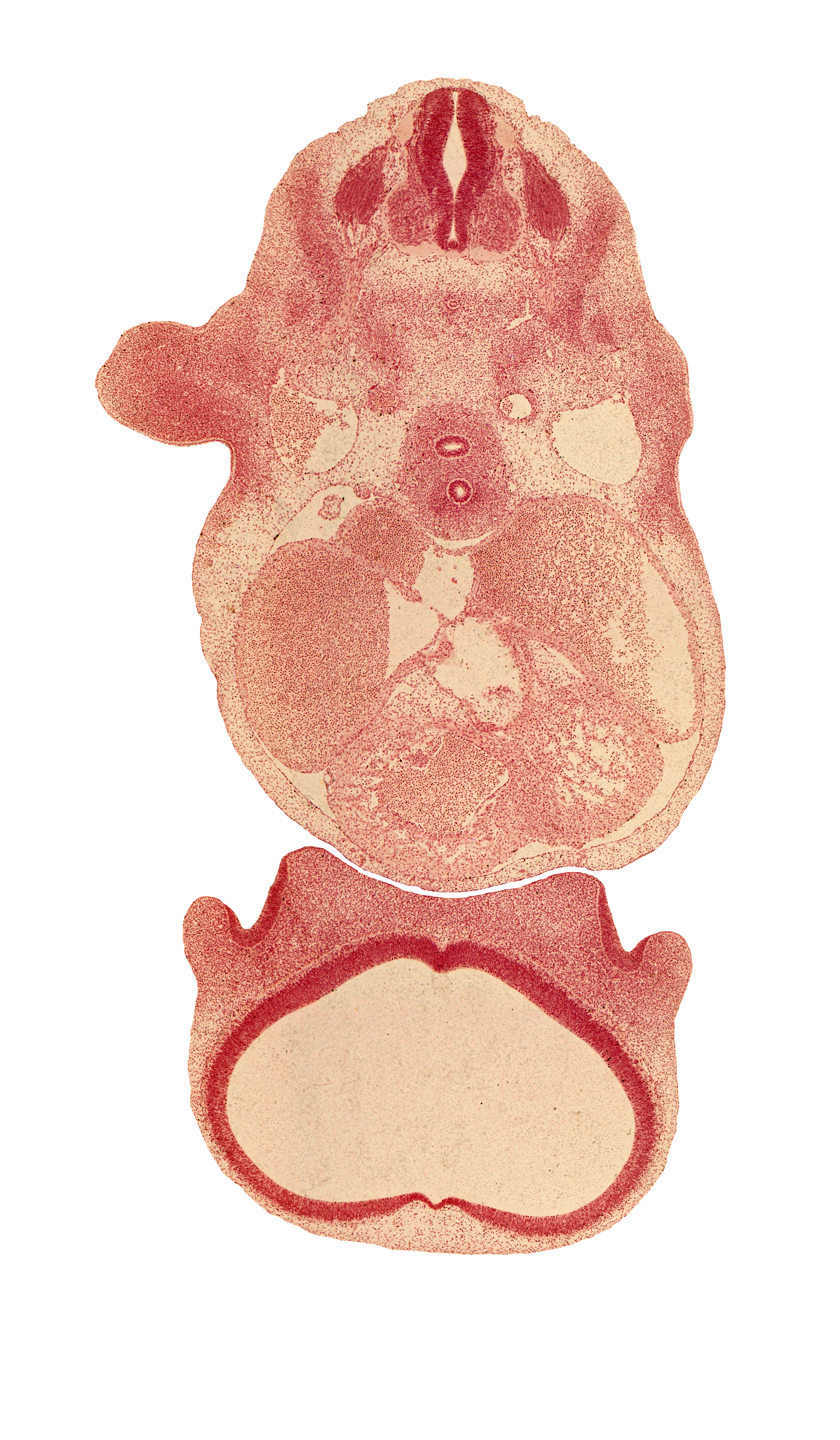 C-5 spinal ganglion, atrioventricular groove, dorsal aorta, esophagus, infundibulum of right ventricle, interventricular foramen, lateral nasal prominence, left atrium, loose cephalic part of sclerotome, medial nasal prominence(s), nasal disc (olfactory placode), notochord, phrenic nerve, precardinal vein, primary interatrial septum (septum primum), region of olfactory filia (CN I), right atrium, sinus venosus, telencephalon medium, trabecular part of right ventricle, trachea, transverse sinus