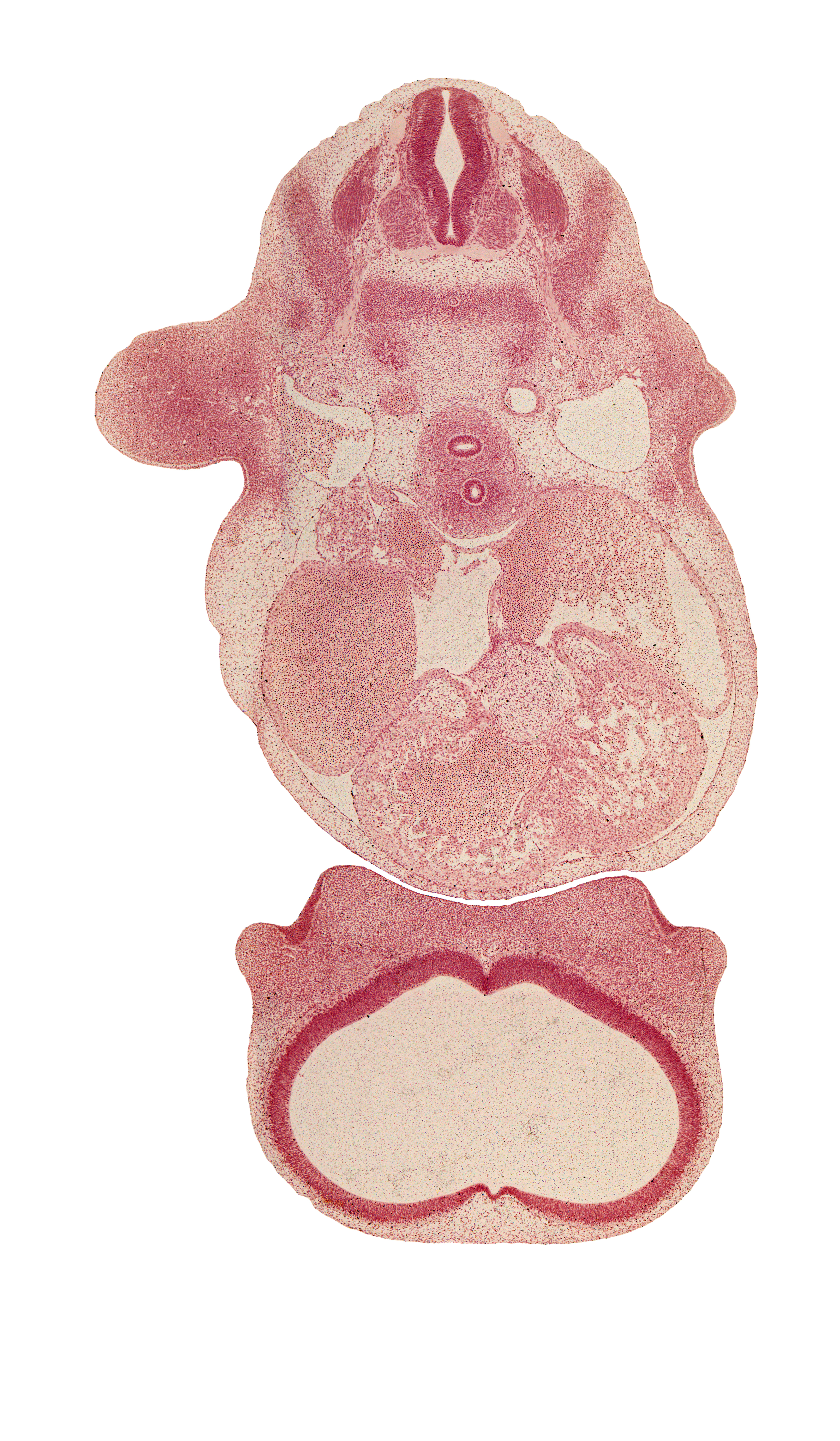 C-5 spinal ganglion, C-5 ventral primary ramus, atrioventricular sulcus, cerebral vesicle (telencephalon), dense caudal part of sclerotome, edge of left atrioventricular canal, edge of nasal disc (olfactory placode), edge of right atrioventricular canal, fused atrioventricular endocardial cushions, lateral nasal prominence, left ventricle, medial nasal prominence(s), precardinal vein, primary interatrial septum (septum primum), primordial meninx, right atrium, shoulder region, subclavian vein, telencephalon medium, trabecular part of right ventricle, transverse sinus, vagus nerve (CN X)