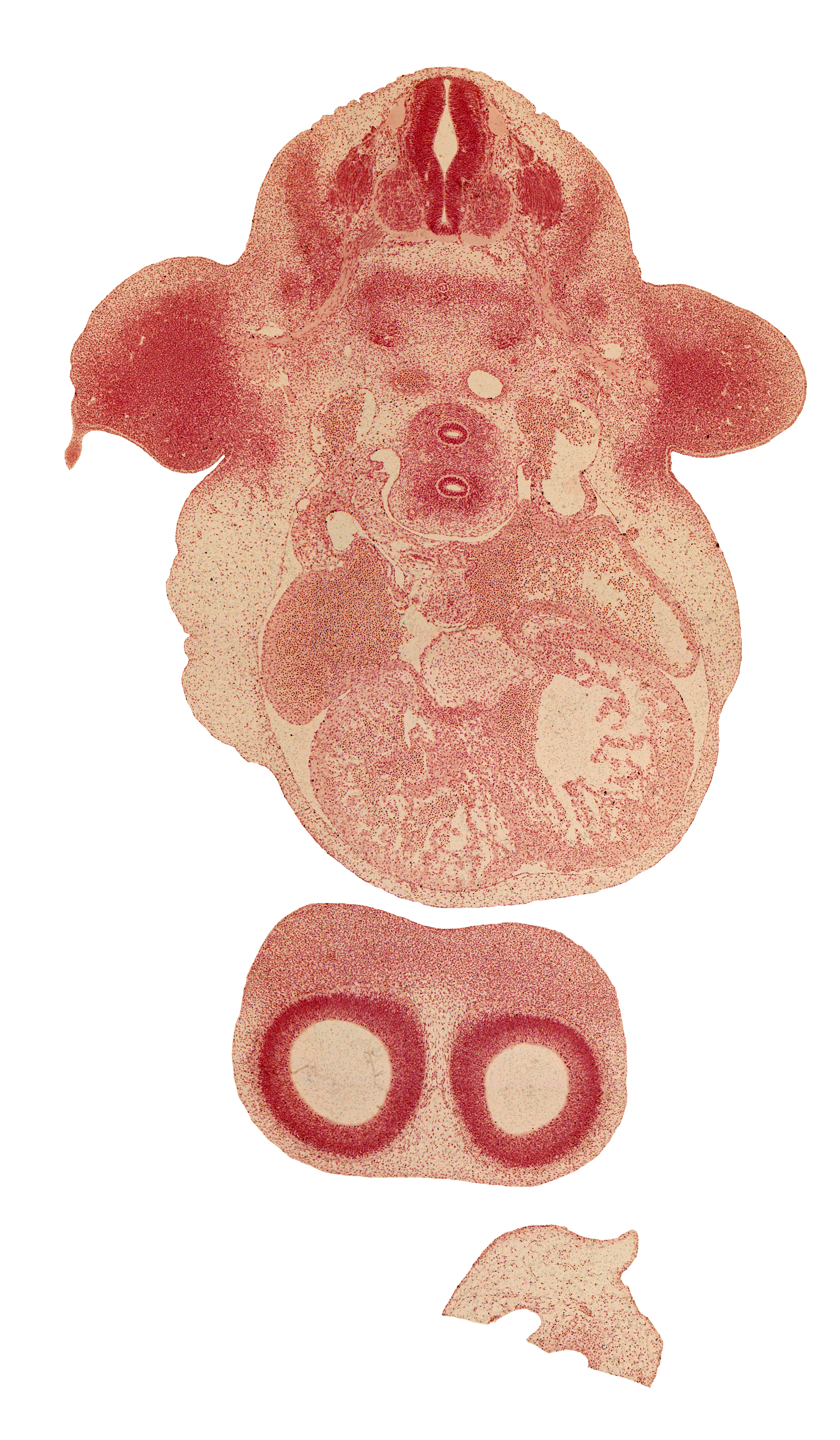 C-6 spinal ganglion, anterior spinal artery, cerebral vesicle (telencephalon), edge of primordial pleural cavity, esophagus, frontal prominence, fused atrioventricular endocardial cushions, lateral ventricle, left atrium, left common cardinal vein, left ventricle, mesenchymal condensation around hindgut, postcardinal vein, right atrioventricular canal, right atrium, right ventricle, sinu-atrial foramen, sinus venosus, sympathetic trunk, trachea, transverse sinus, ventral primary ramus