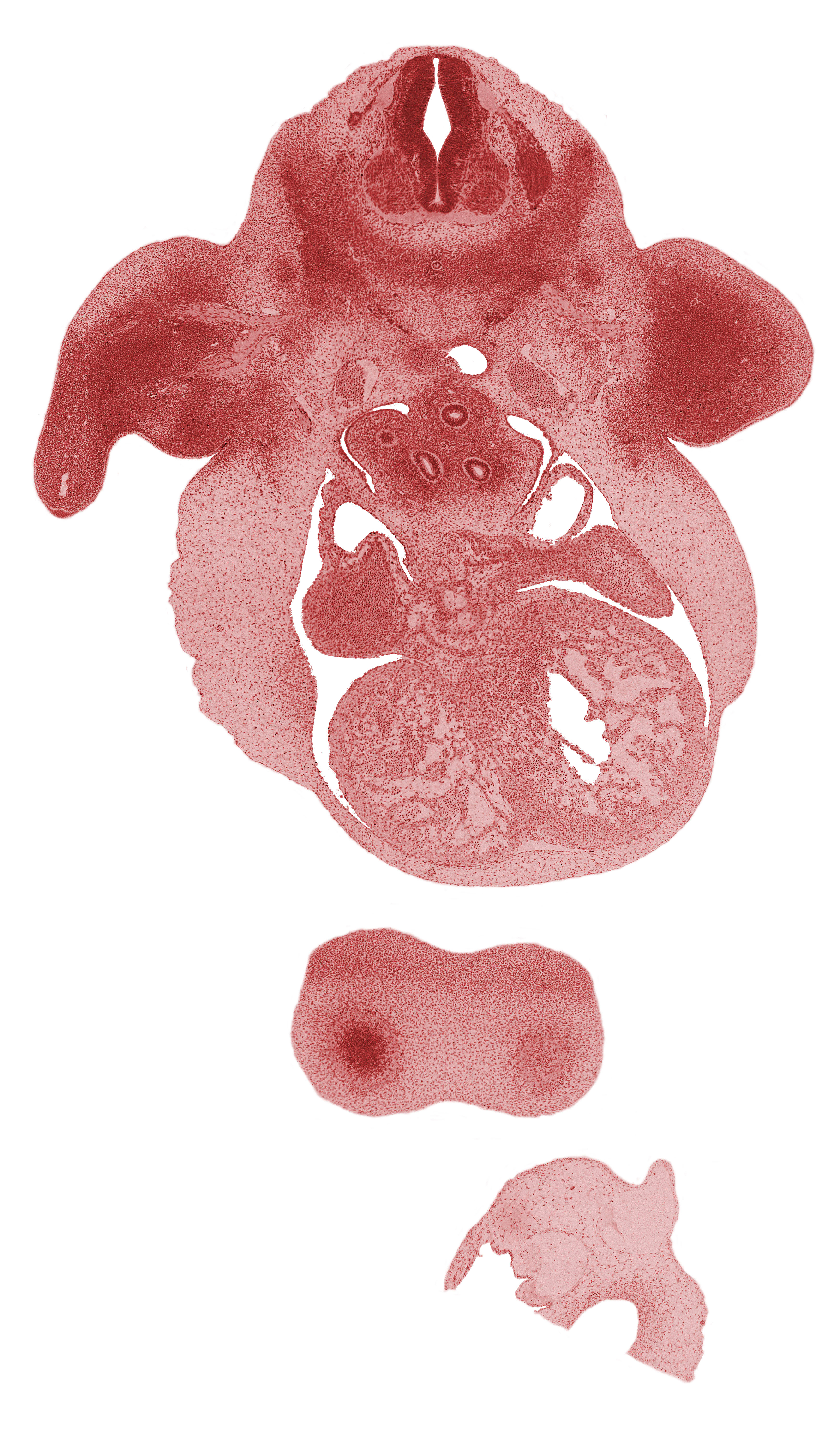 C-6 spinal ganglion, brachial plexus, cerebral vesicle (telencephalon), esophagus, frontal prominence, junction of dorsal aortas, left atrium, left common cardinal vein, notochord, pleuropericardial fold, postcardinal vein, right atrium, right venous valve, right ventricle, sinus venosus, sympathetic trunk, trabecular part of left ventricle, vascular plexus on surface of cerebral vesicle