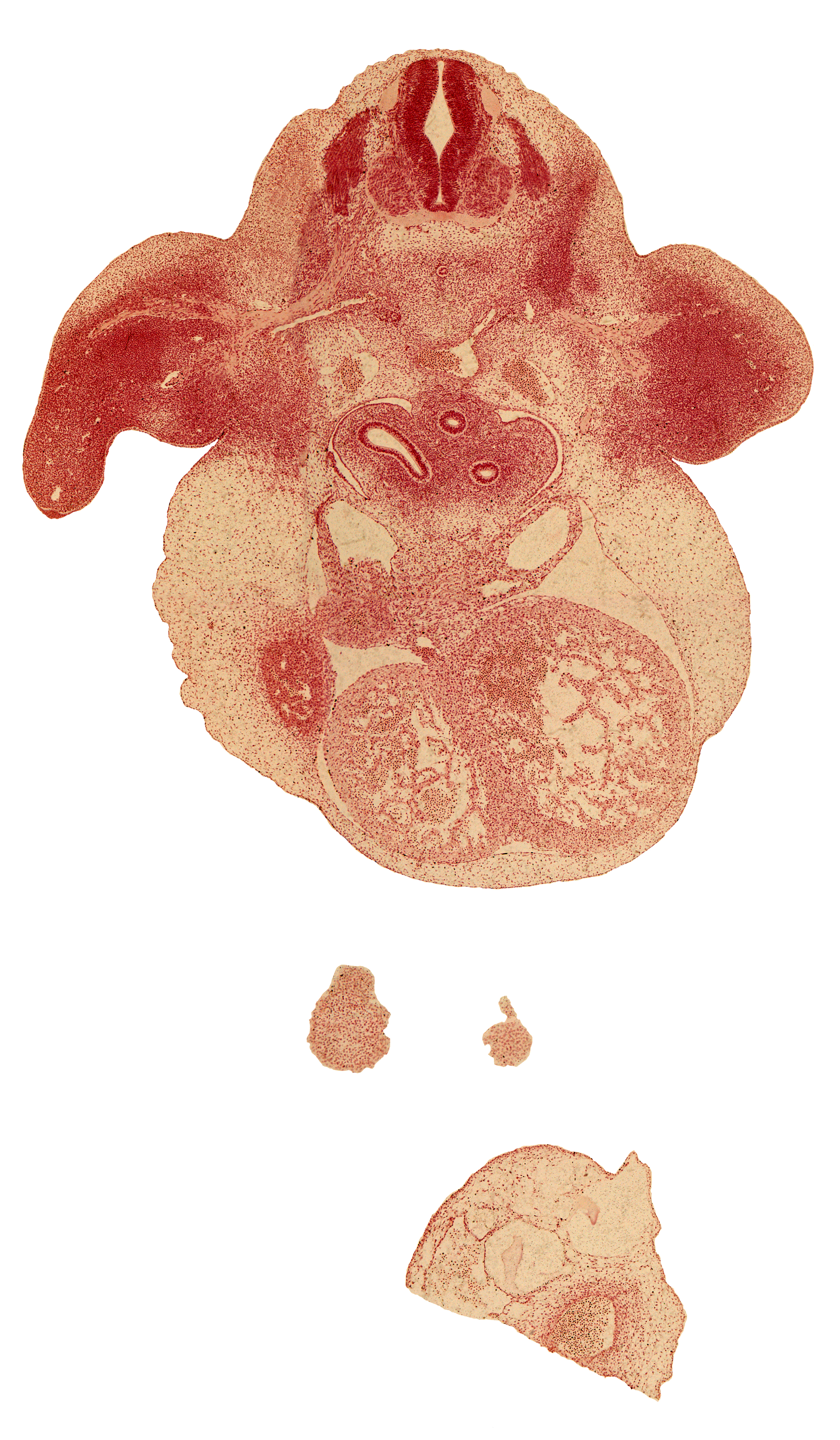 anterior spinal artery, apical epidermal ridge, cephalic edge of C-7 spinal ganglion, dorsal intersegmental artery, dorsal meso-esophagus, edge of frontal prominence, heart prominence, junction of left common cardinal vein and left sinus horn, left horn of sinus venosus, left ventricle, liver, marginal vein, muscular part of interventricular septum, notochord, phrenic nerve, postcardinal vein, right atrium, sinus venosus, subclavian artery