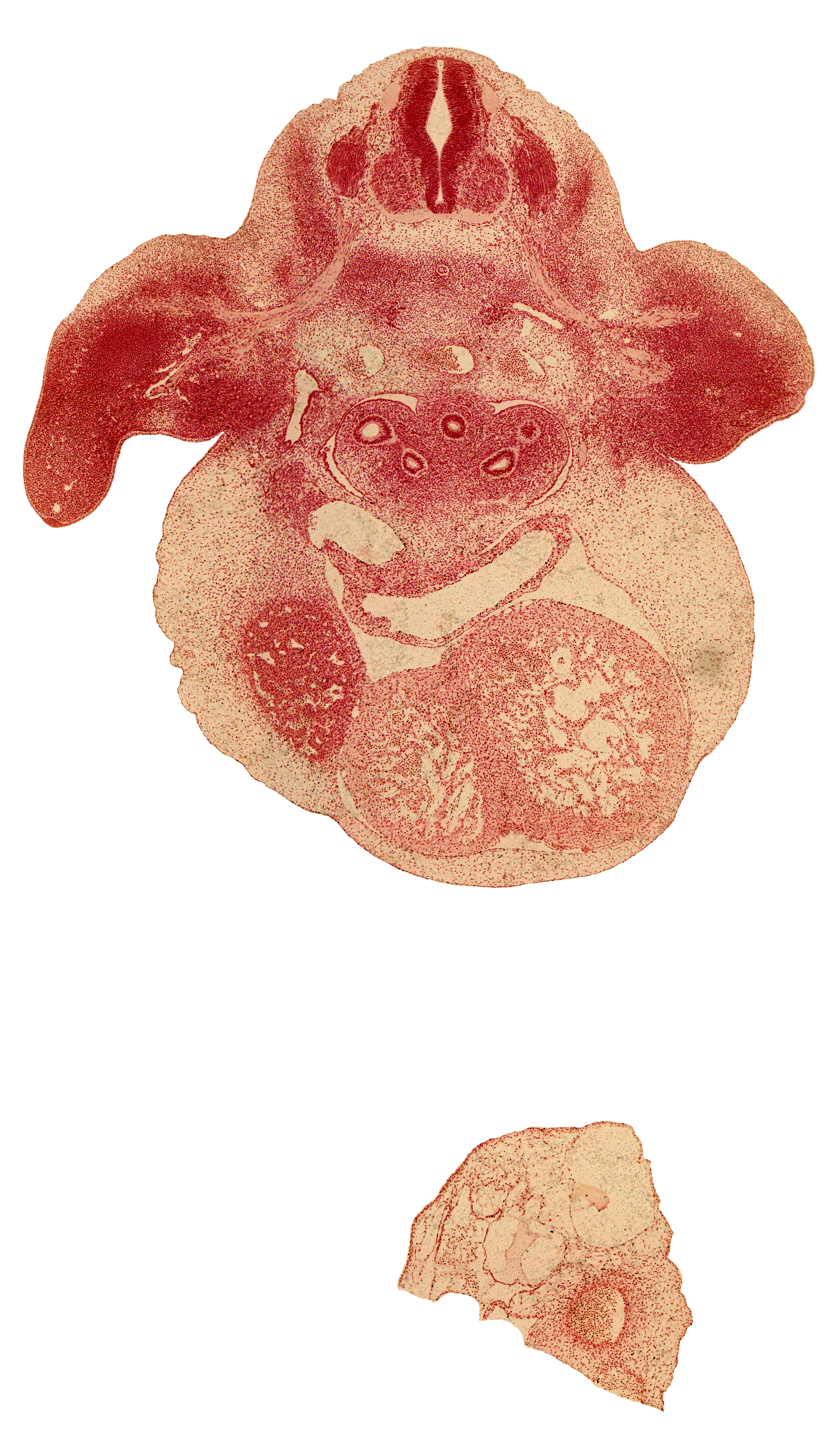 C-7 spinal ganglion, C-7 ventral primary ramus, aorta, brachial artery, esophagus, interventricular sulcus, left horn of sinus venosus, left ventricle, liver, muscular part of interventricular septum, notochord, pericardial cavity, postcardinal vein, primary bronchus, right ventricle, septum transversum, sinus venosus, subclavian artery, sympathetic trunk, upper limb, upper secondary bronchus bud