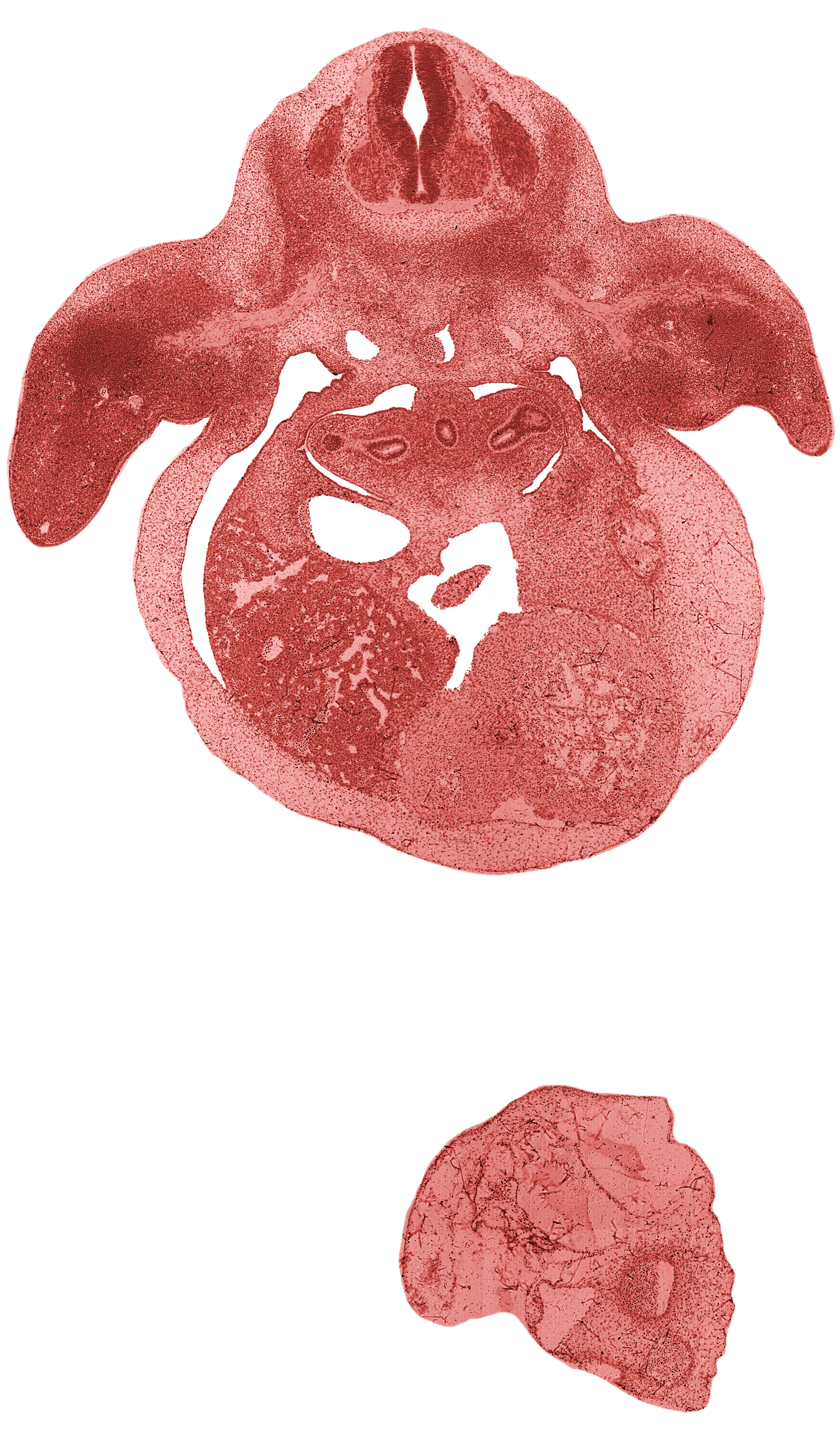 C-7 spinal ganglion, brachial artery, dorsal intersegmental artery, dorsal meso-esophagus, edge of left horn of sinus venosus, edge of middle secondary bronchus bud, edge of upper secondary bronchus bud, liver prominence, median nerve, neural arch, pericardial cavity, peritoneal cavity, primary bronchus, primordial pleural cavity, right lobe of liver, septum transversum