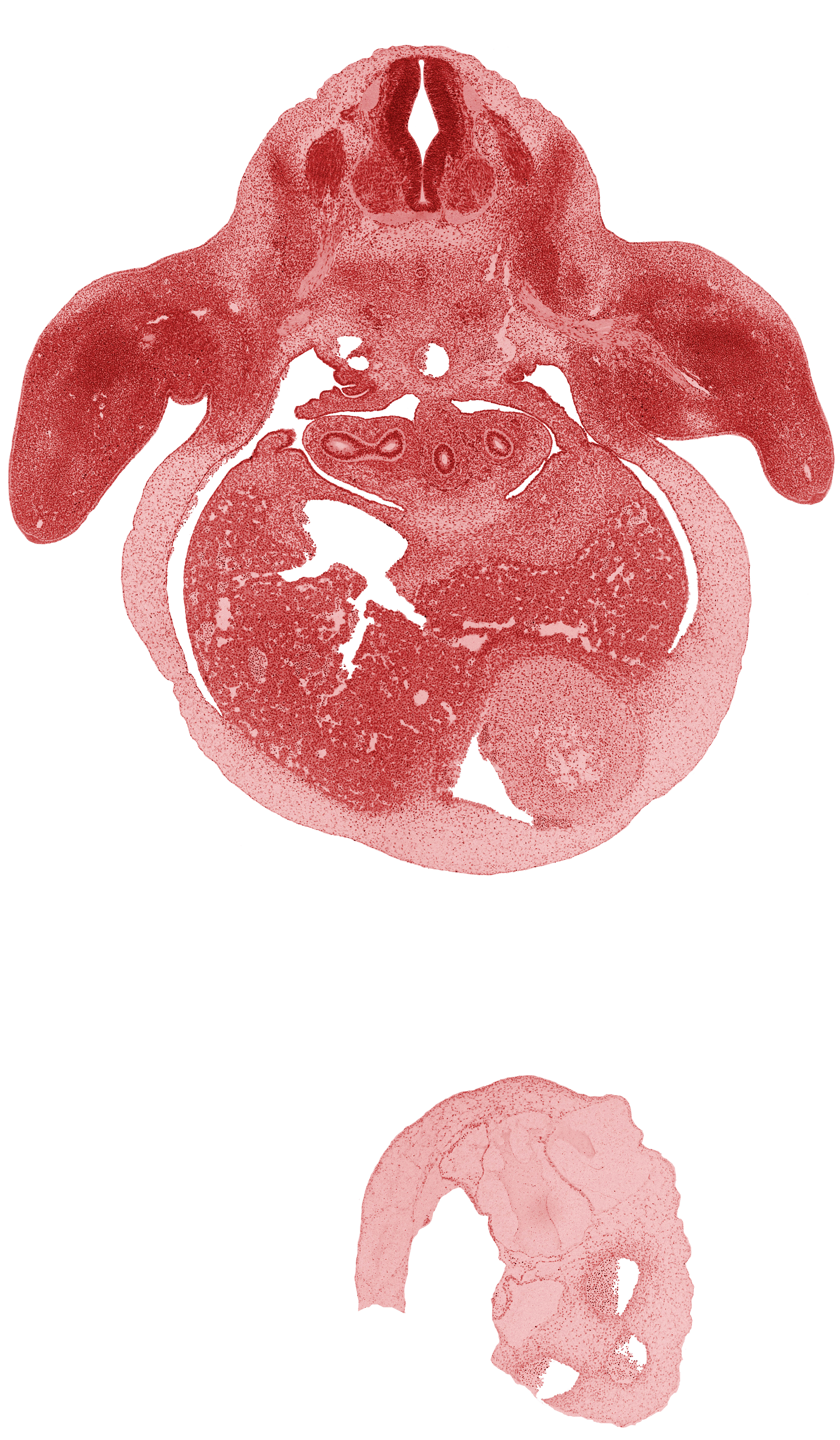 aorta, brachial plexus, dorsal fasciculus, efferent hepatic veins, forearm, hepatic part of inferior vena cava, left lobe of liver, left ventricle, lower secondary bronchus bud, median nerve, middle secondary bronchus bud, neural arch, pericardial cavity, pleuroperitoneal membrane, postcardinal vein, primordial paramesonephric groove, roof plate, septum transversum, union of C-7 and C-8 spinal ganglia
