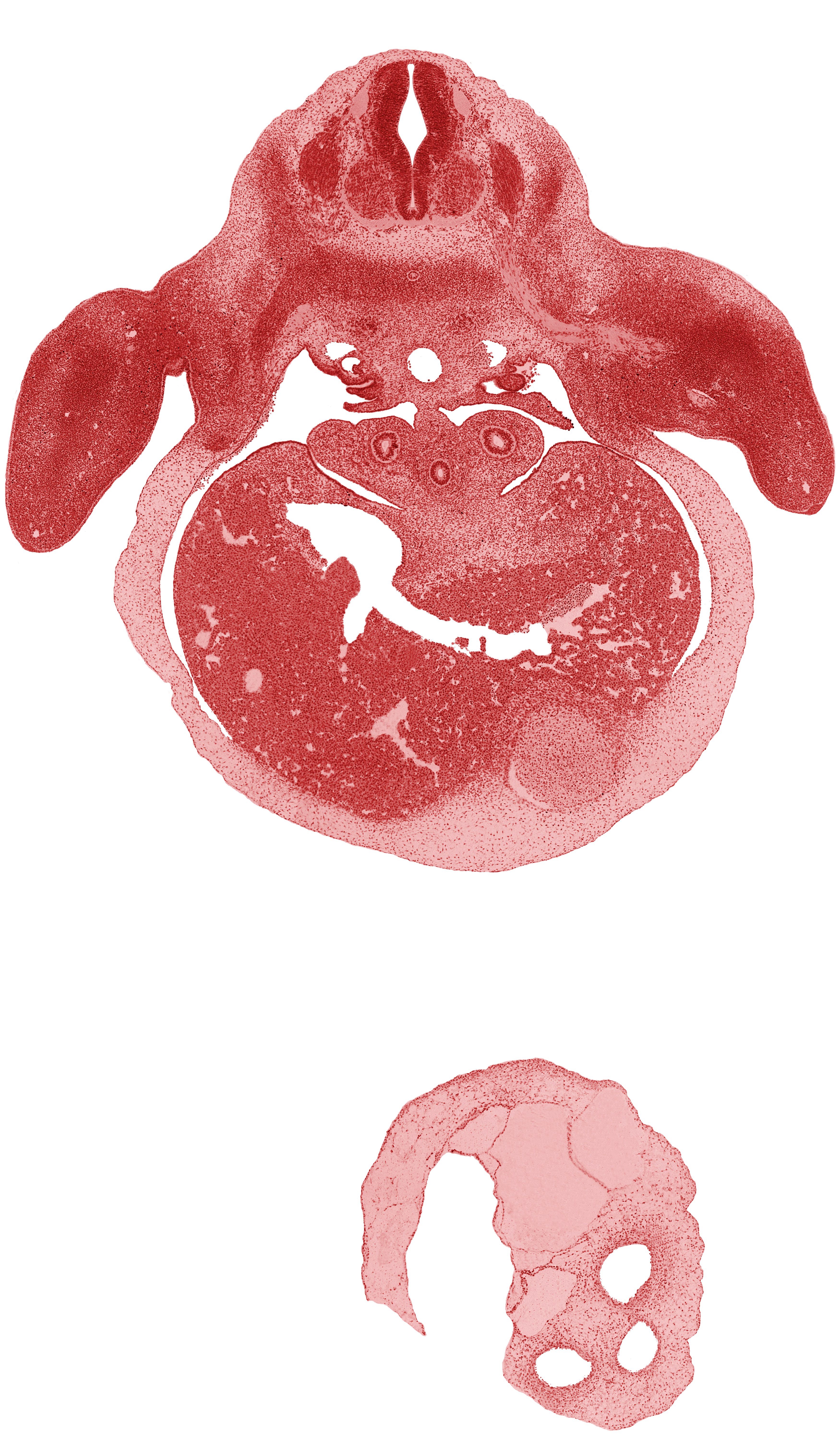 C-8 spinal ganglion, C-8 spinal nerve, abdominal wall, aorta, brachial plexus, dorsal meso-esophagus, efferent hepatic veins, esophagus, hepatic part of inferior vena cava, left lobe of liver, left ventricle, median nerve, pleuroperitoneal membrane, pleuroperitoneal opening, postcardinal vein, primordial paramesonephric groove