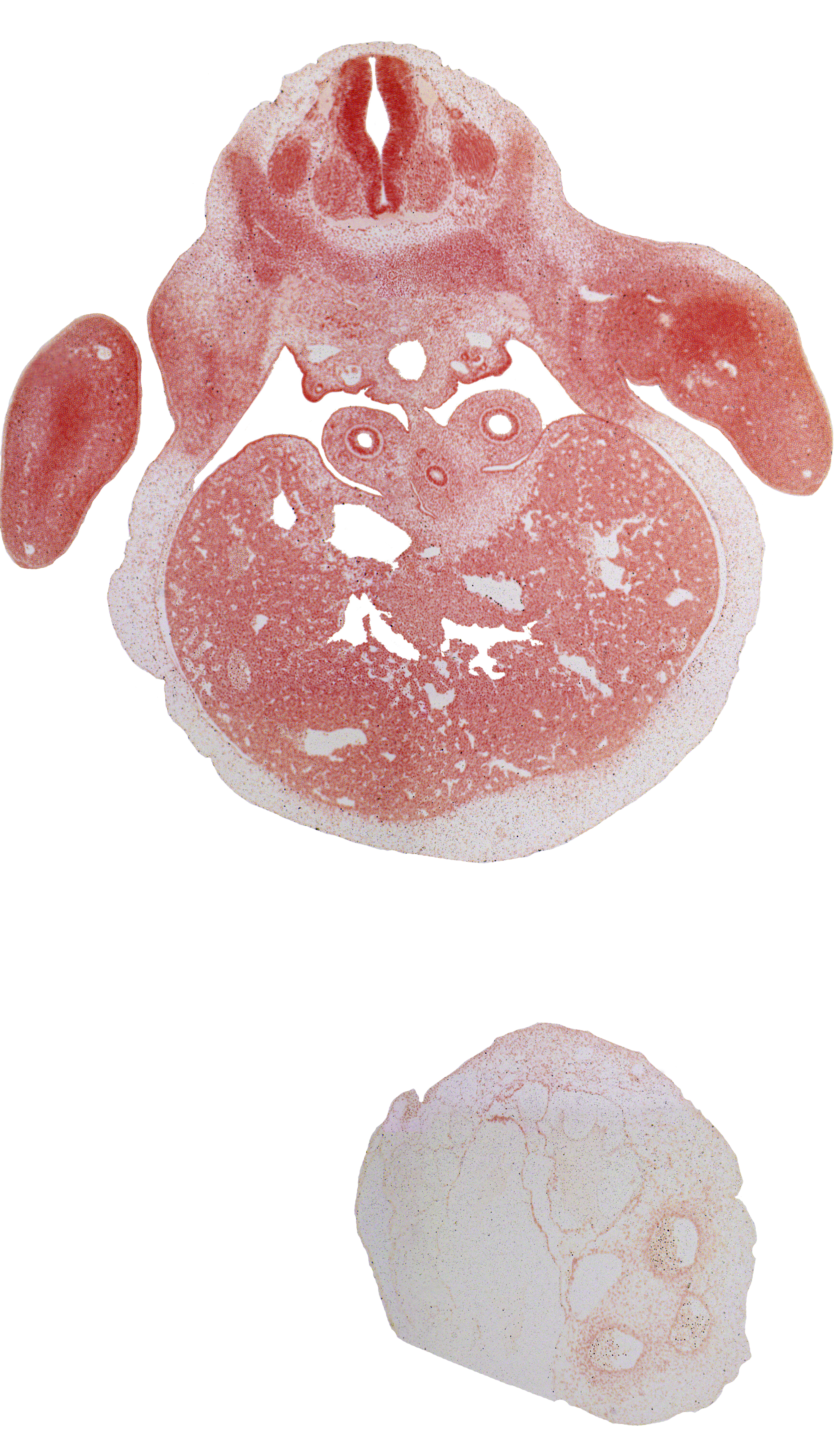 C-8 spinal ganglion, T-1 ventral primary ramus, abdominal wall mesenchyme, axial artery, cephalic end of mesonephric duct, dorsal fasciculus, dorsal meso-esophagus, ductus venosus, left lobe of liver, liver prominence, neural arch, peritoneal cavity, pleuroperitoneal membrane, pleuroperitoneal opening, postcardinal vein, right lobe of liver, sympathetic trunk, ulnar nerve