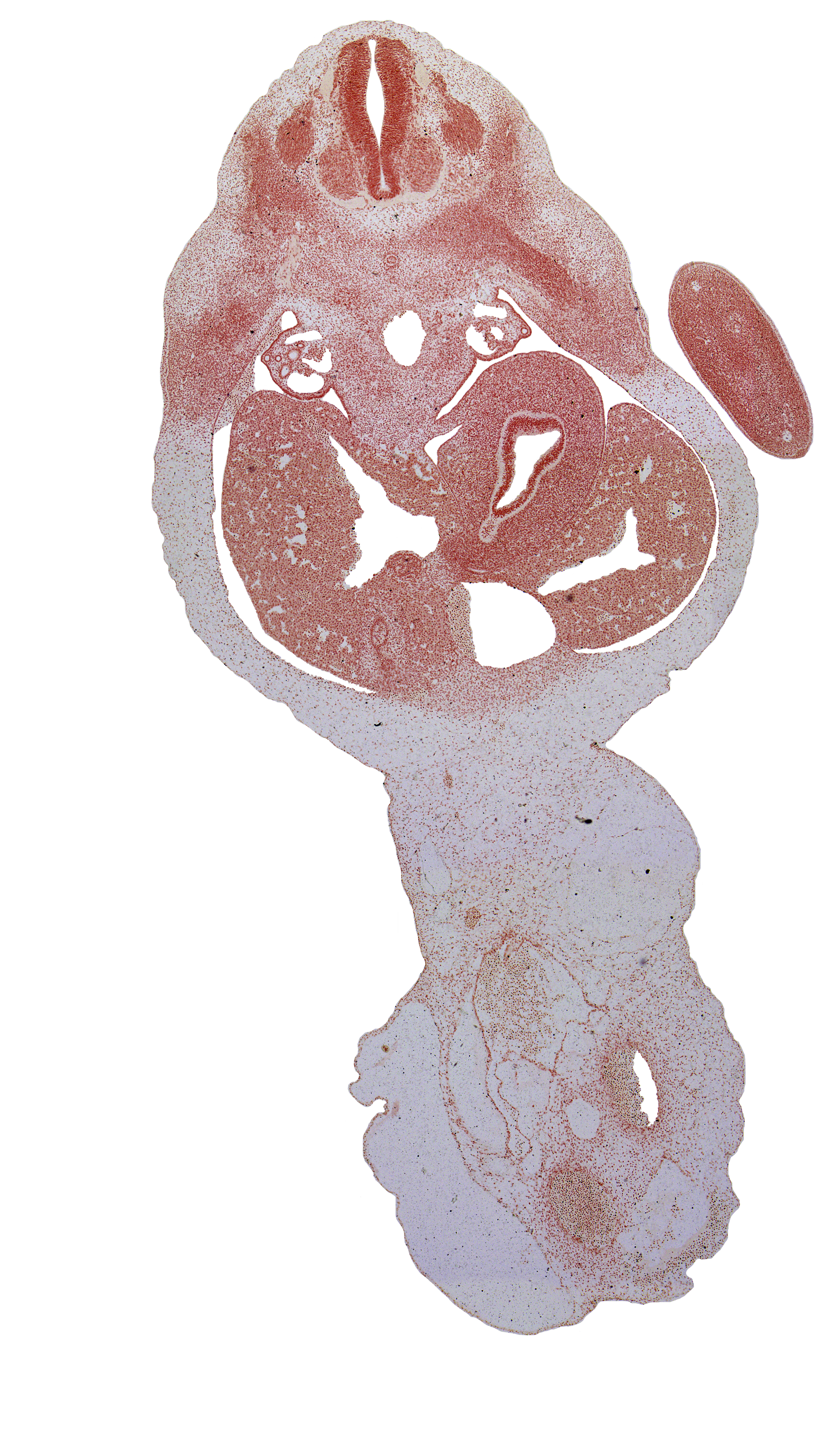 T-1 dorsal root, T-2 spinal ganglion, T-3 intercostal nerve, afferent hepatic vein, blastema of rib 3, caudal edge of gall bladder, cystic duct, dorsal mesogastrium, ductus venosus, junction of duodenum and stomach, mesonephric duct, postcardinal vein, sympathetic trunk