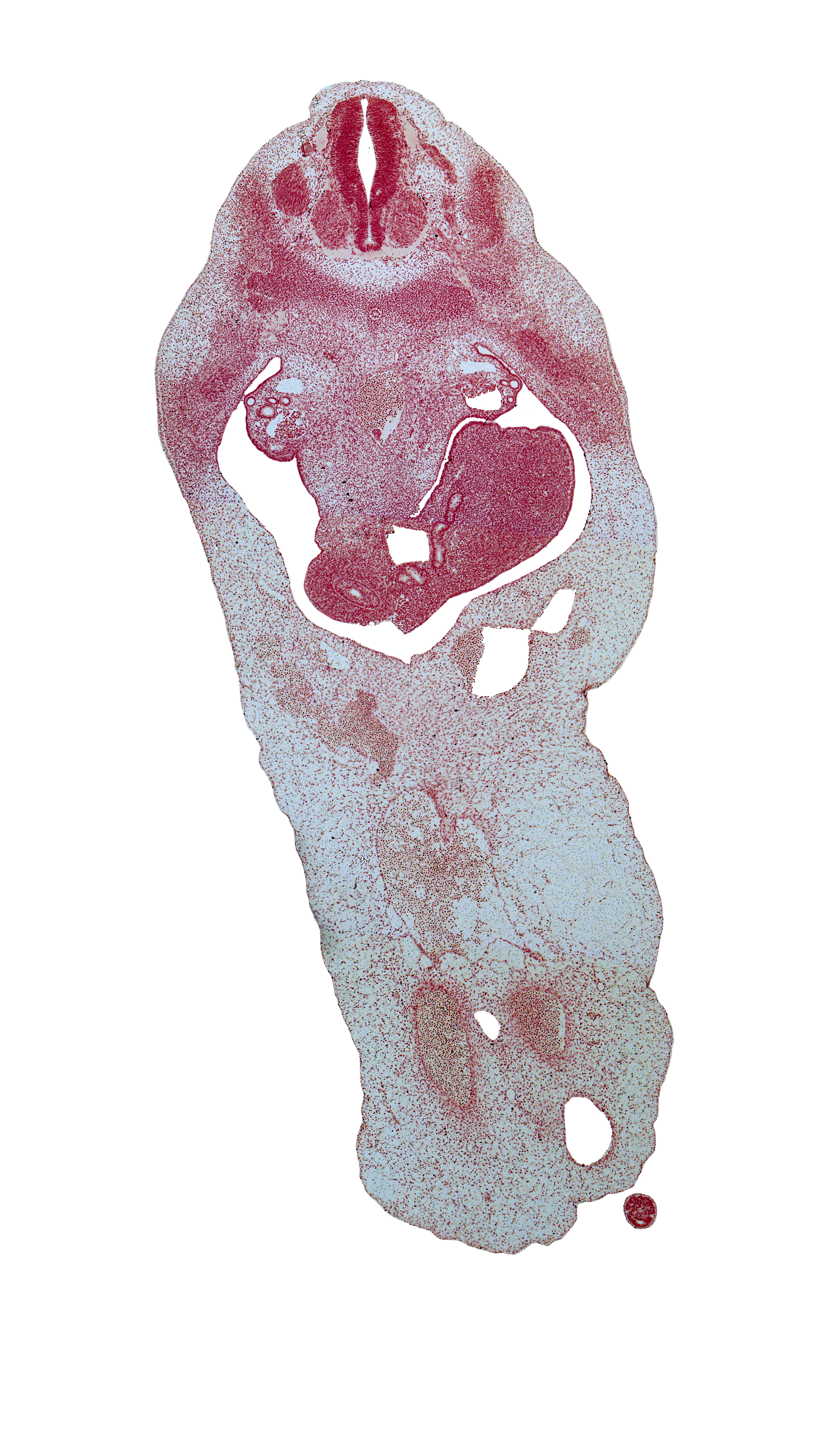 T-3 dorsal root, T-4 spinal nerve, blastema of rib 5, caudal eminence, cephalic edge of T-4 spinal ganglion, dorsal mesogastrium, dorsal pancreas, duodenum, left umbilical artery, mesonephric duct, mesonephros, notochord, peritoneal cavity, postcardinal vein, right umbilical artery, superior mesenteric vein, umbilical cord, umbilical vein