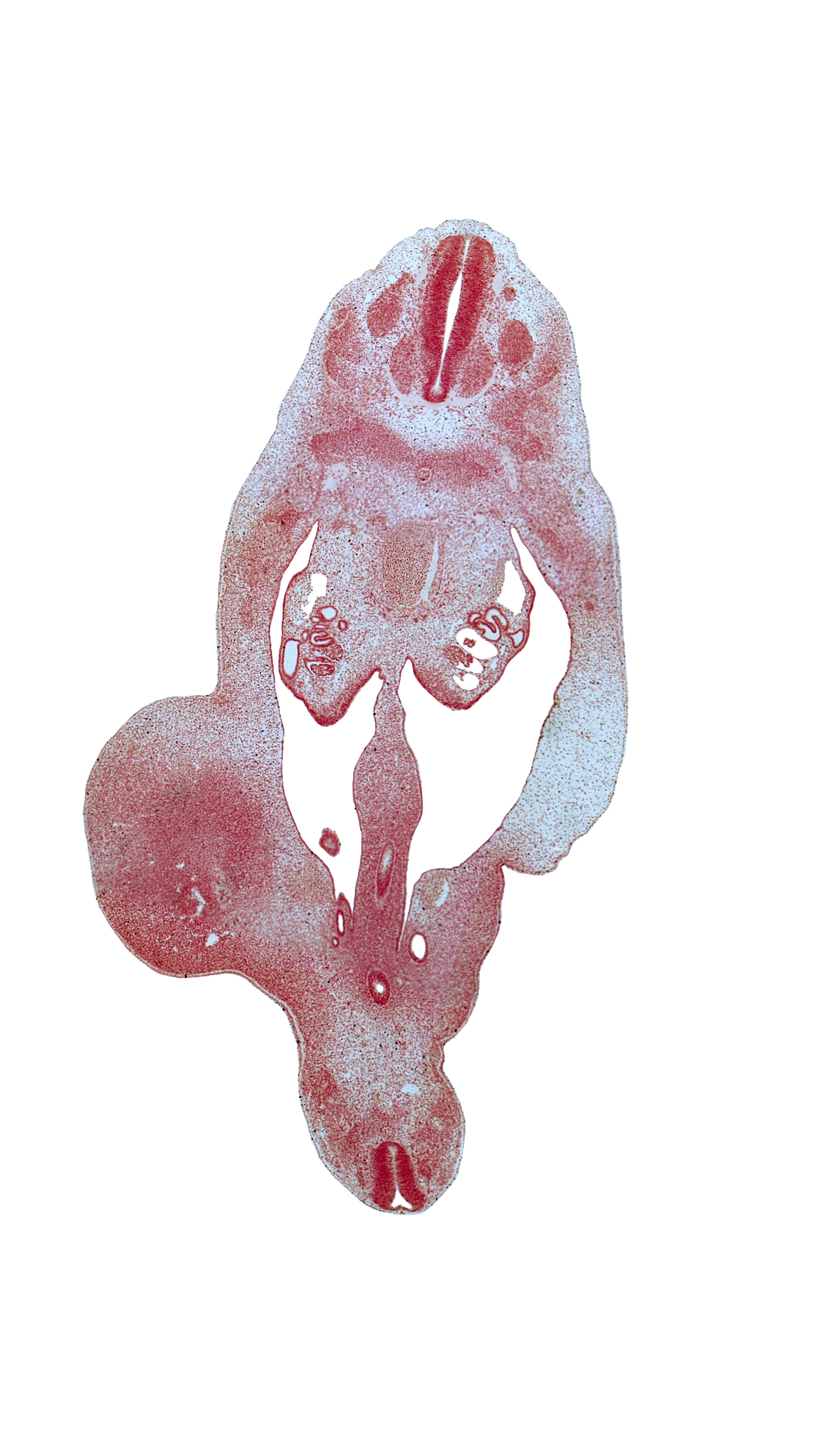 T-8 spinal ganglion, T-9 dorsal and ventral roots, T-9 spinal nerve, aorta, blastema of rib 9, caudal eminence, coccygeal mesoderm, dorsal mesentery, gonadal ridge, hindgut, horn of urogenital sinus, left umbilical artery, mesonephric duct, mesonephric duct near junction with urogenital sinus, peritoneal cavity, postcardinal vein, primordial meninx, rectum, right umbilical artery