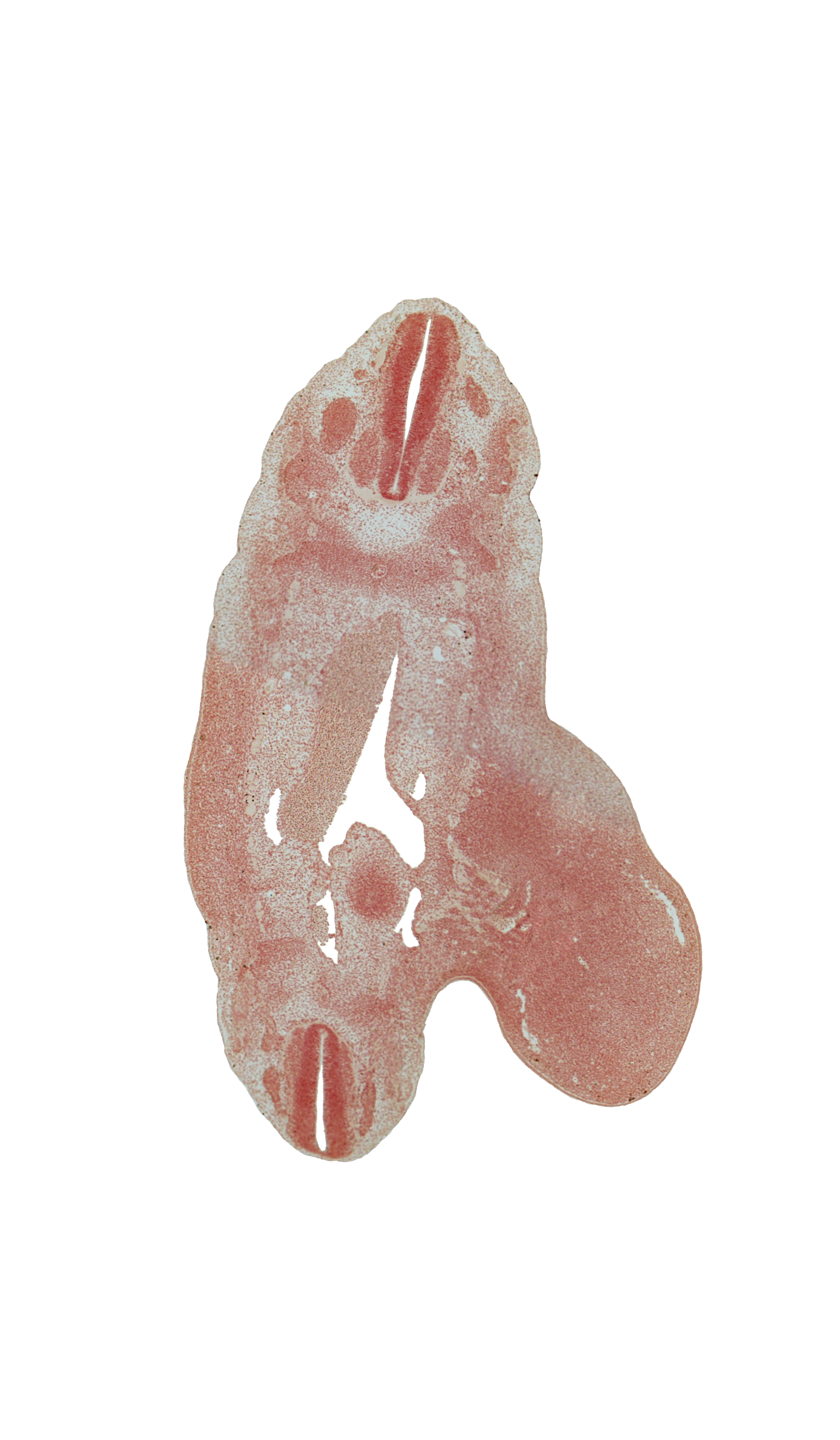 L-1 ventral primary ramus, S-3 spinal ganglion, T-10 spinal ganglion, T-11 ventral root, T-12 spinal nerve, aorta, aortic bifurcation, dense caudal part of sclerotome, lower limb, lumbar plexus, lumbosacral plexus, median sacral artery, metanephrogenic blastema, notochord, postcardinal vein, rib 12 blastema