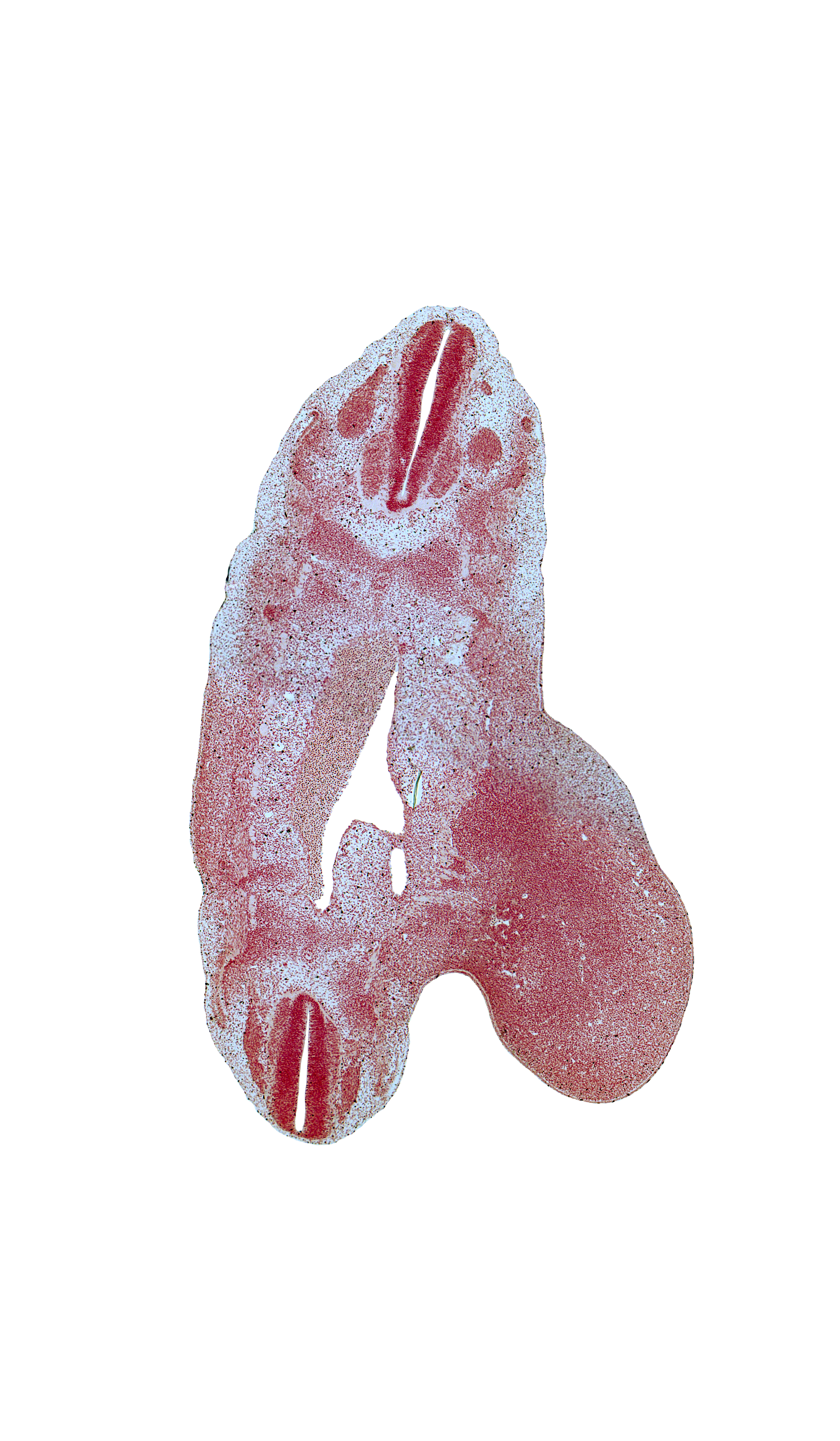 L-1 ventral primary ramus, S-2 ventral primary ramus, S-3 spinal ganglion, T-11 spinal ganglion, T-12 spinal nerve, alar plate(s), basal plate, floor plate, lumbar plexus, lumbosacral plexus, median sacral artery, notochord, roof plate, sulcus limitans