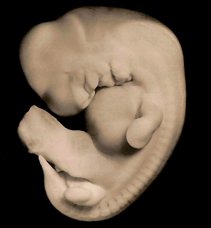 Left lateral view of the embryo prior to sectioning