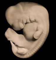 Left lateral view of the embryo prior to sectioning