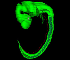 Nervous System