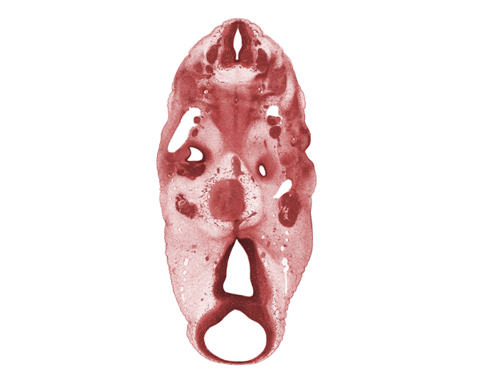 C-3 spinal ganglion, basal plate cartilage, cochlear duct part of otic vesicle, diencephalon, inferior ganglion of glossopharyngeal nerve (CN IX), mesencephalon (M1), metencephalon (pons), notochord, oculomotor nerve (CN III), otic capsule condensation, pontine flexure region, posterior communicating artery, precardinal vein, sclerotome, spinal accessory nerve (CN XI), trigeminal ganglion (CN V), trochlear nerve (CN IV), vagus nerve (CN X), vascular plexus