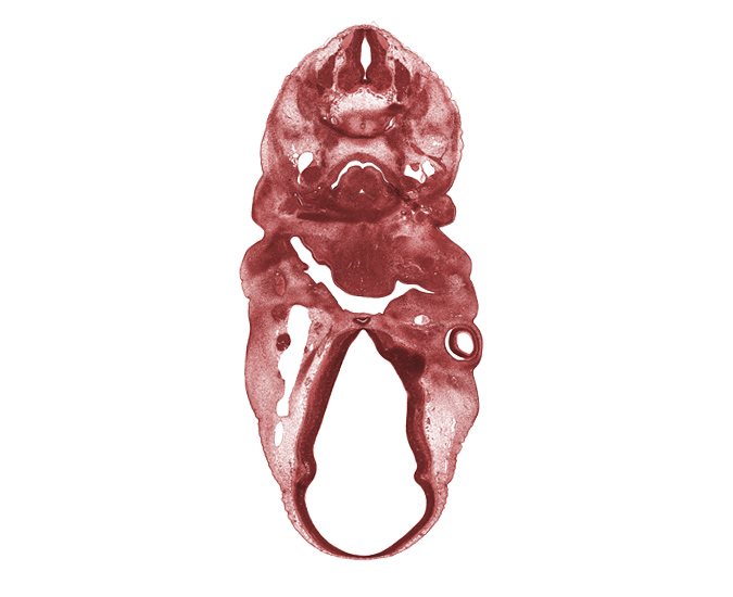 C-5 spinal ganglion, arytenoid swelling, dorsal sulcus, dorsal thalamus, epimere, hypoglossal nerve (CN XII), marginal ridge, middle sulcus, optic chiasma (chiasmatic plate), precartilage condensation of pharyngeal arch 1 (Meckel), precartilage condensation of pharyngeal arch 3, primary head vein, primordium of lateral palatine process, spinal accessory nerve (CN XI), sympathetic trunk, thyroglossal duct, tongue, trapezius muscle, vagus nerve (CN X), ventral thalamus