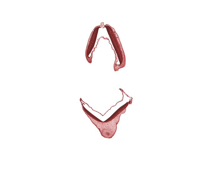 alar plate of metencephalon, alar plate of myelencephalon, edge of mesencephalon, head mesenchyme, roof plate