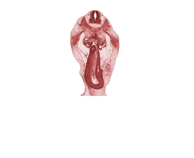 T-12 / L-1 interganglion region, aorta, cecum, distal limb of herniated midgut, duodenum, gonadal ridge, mesonephric duct, midgut mesentery, peritoneal cavity, umbilical coelom, umbilical cord, umbilical vein