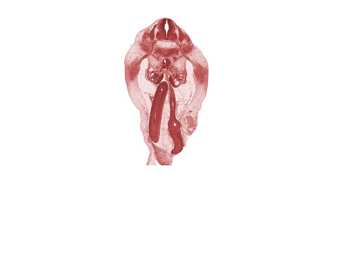 L-1 spinal ganglion, L-1 spinal nerve, communicating ramus, distal limb of herniated midgut, epimere, hypomere, mesonephric duct, missing tissue (artifact), postcardinal vein, proximal limb of herniated midgut, sympathetic trunk, umbilical coelom