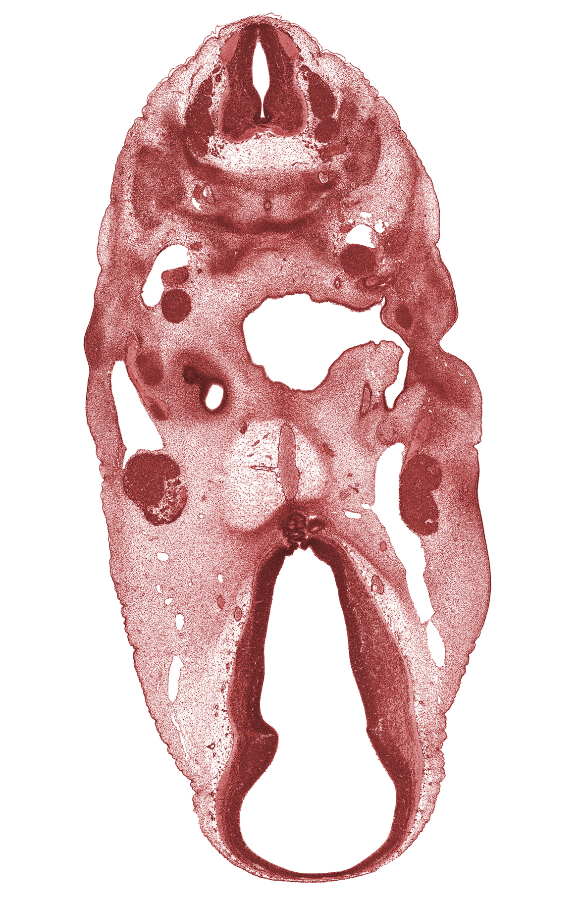 C-3 spinal ganglion, C-3 spinal nerve, C-4 spinal ganglion, basilar artery, cervical plexus, dorsal thalamus, edge of cochlear duct, facial nerve (CN VII), geniculate ganglion (CN VII), hypothalamus, inferior ganglion of vagus nerve (CN X), infundibular recess, internal carotid artery, marginal ridge, middle sulcus, motor root of trigeminal nerve (CN V), neural arch, notochord, oronasal cavity, pharyngeal groove 1, primary head vein, spinal accessory nerve (CN XI), ventral thalamus, vertebral artery