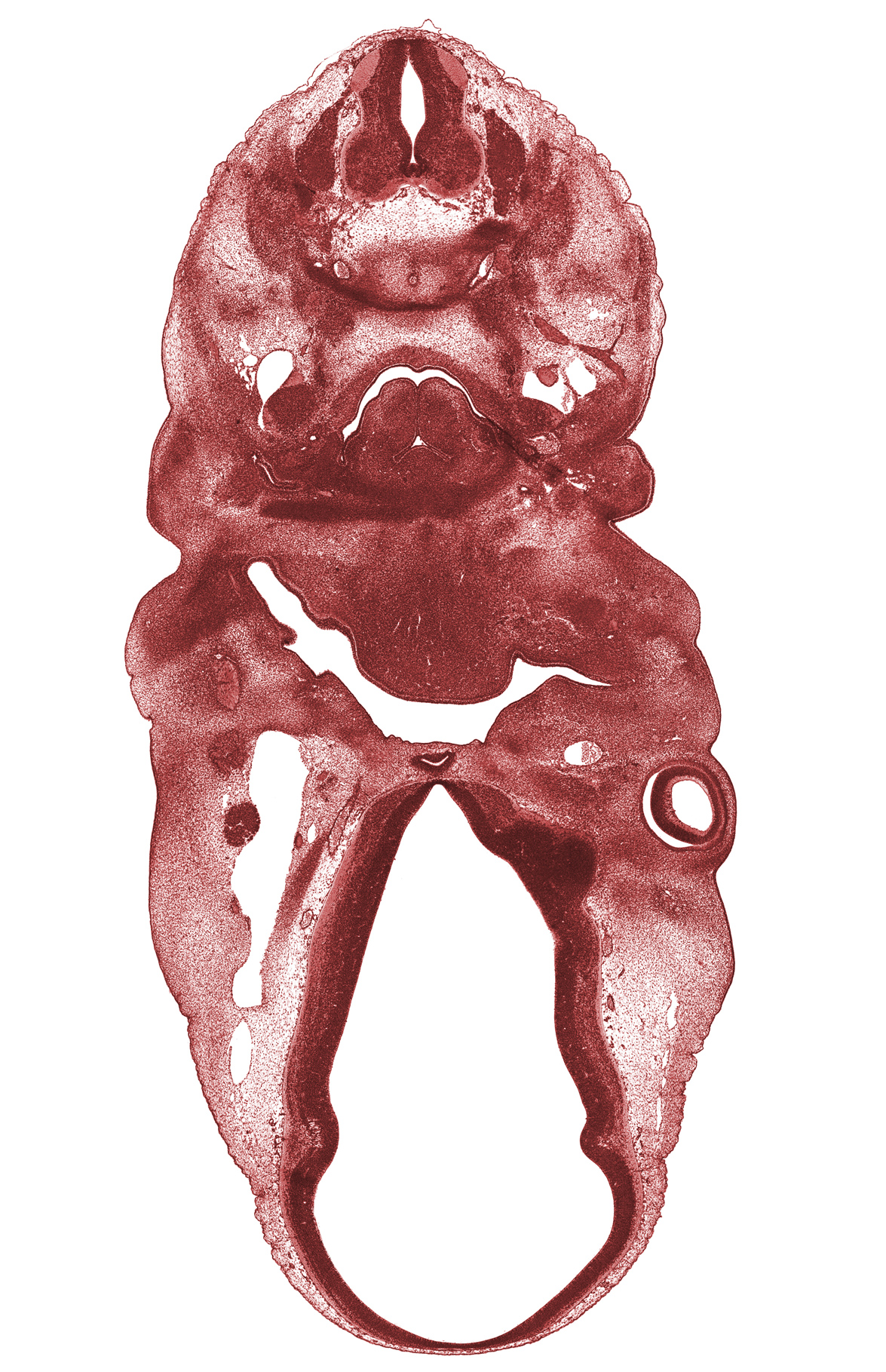 C-5 spinal ganglion, arytenoid swelling, dorsal sulcus, dorsal thalamus, epimere, hypoglossal nerve (CN XII), marginal ridge, middle sulcus, optic chiasma (chiasmatic plate), precartilage condensation of pharyngeal arch 1 (Meckel), precartilage condensation of pharyngeal arch 3, primary head vein, primordium of lateral palatine process, spinal accessory nerve (CN XI), sympathetic trunk, thyroglossal duct, tongue, trapezius muscle, vagus nerve (CN X), ventral thalamus