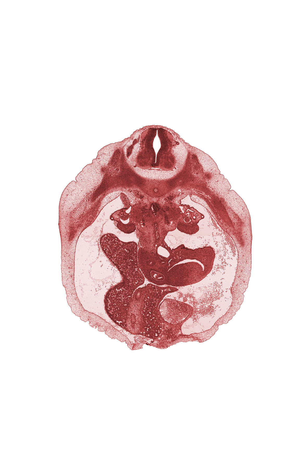 T-9 / T-10 interganglion region, anterior abdominal wall, bile duct, caudal edge of spleen, cystic duct, duct of dorsal pancreas, duodenum, falciform ligament, gall bladder, lesser sac (omental bursa), notochord, postcardinal vein, rib 10, superior mesenteric artery, superior mesenteric vein, umbilical vein