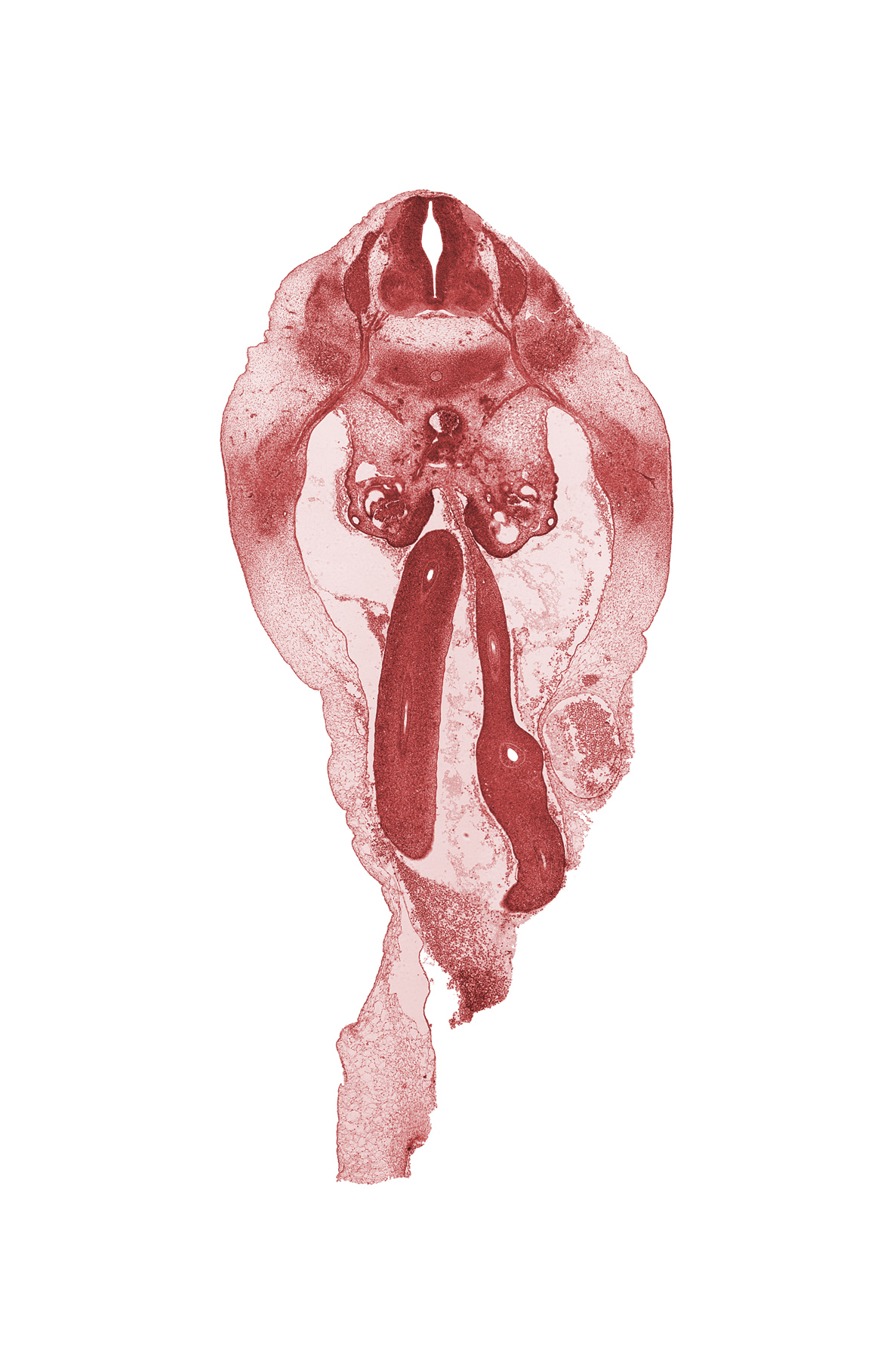 L-1 spinal ganglion, L-1 spinal nerve, communicating ramus, distal limb of herniated midgut, epimere, hypomere, mesonephric duct, missing tissue (artifact), postcardinal vein, proximal limb of herniated midgut, sympathetic trunk, umbilical coelom