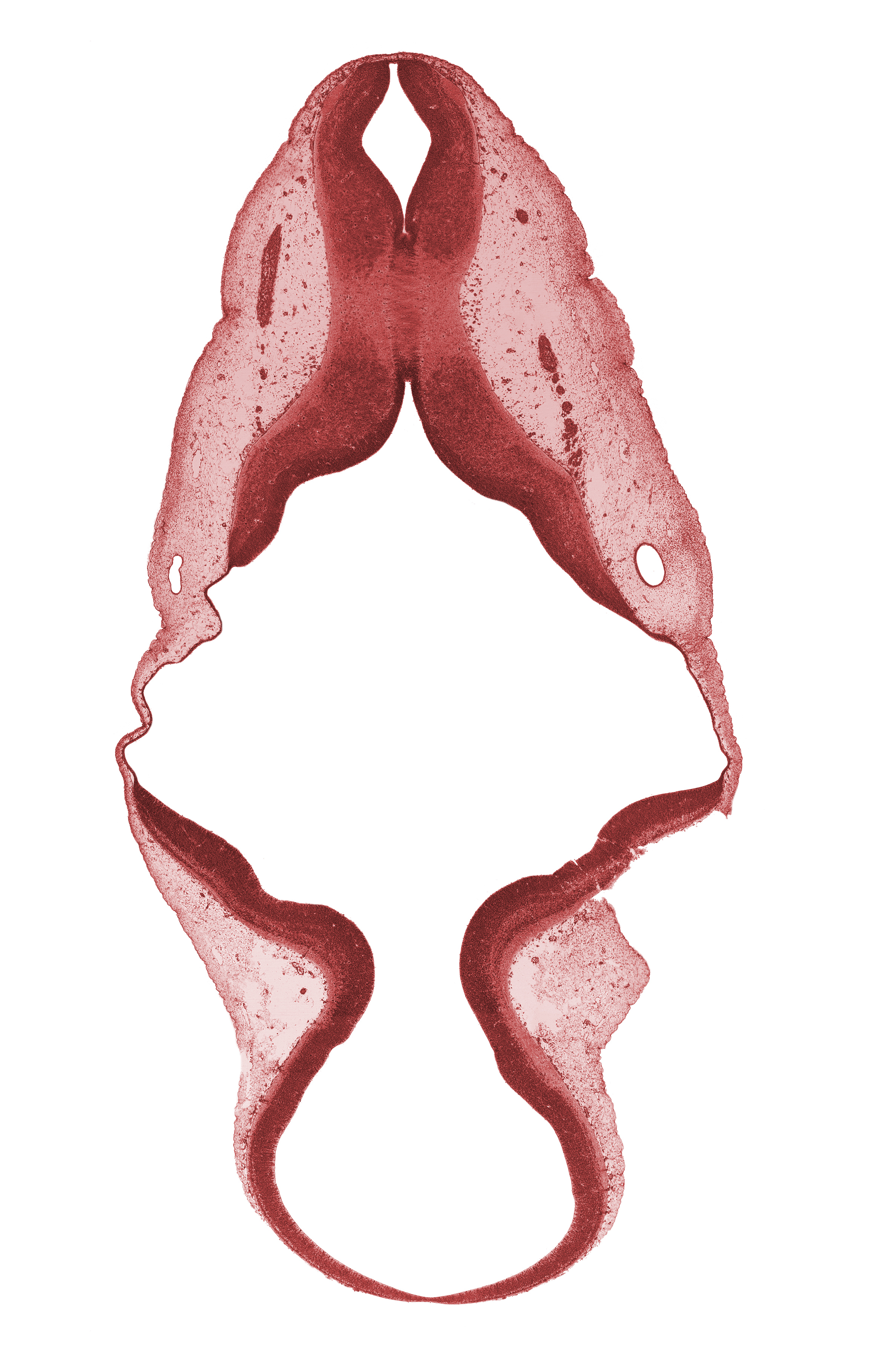 accessory nerve (CN XI), alar plate(s), mesencephalon, missing tissue (artifact), myelencephalon, roof plate, root of vagus nerve (CN X), sulcus limitans