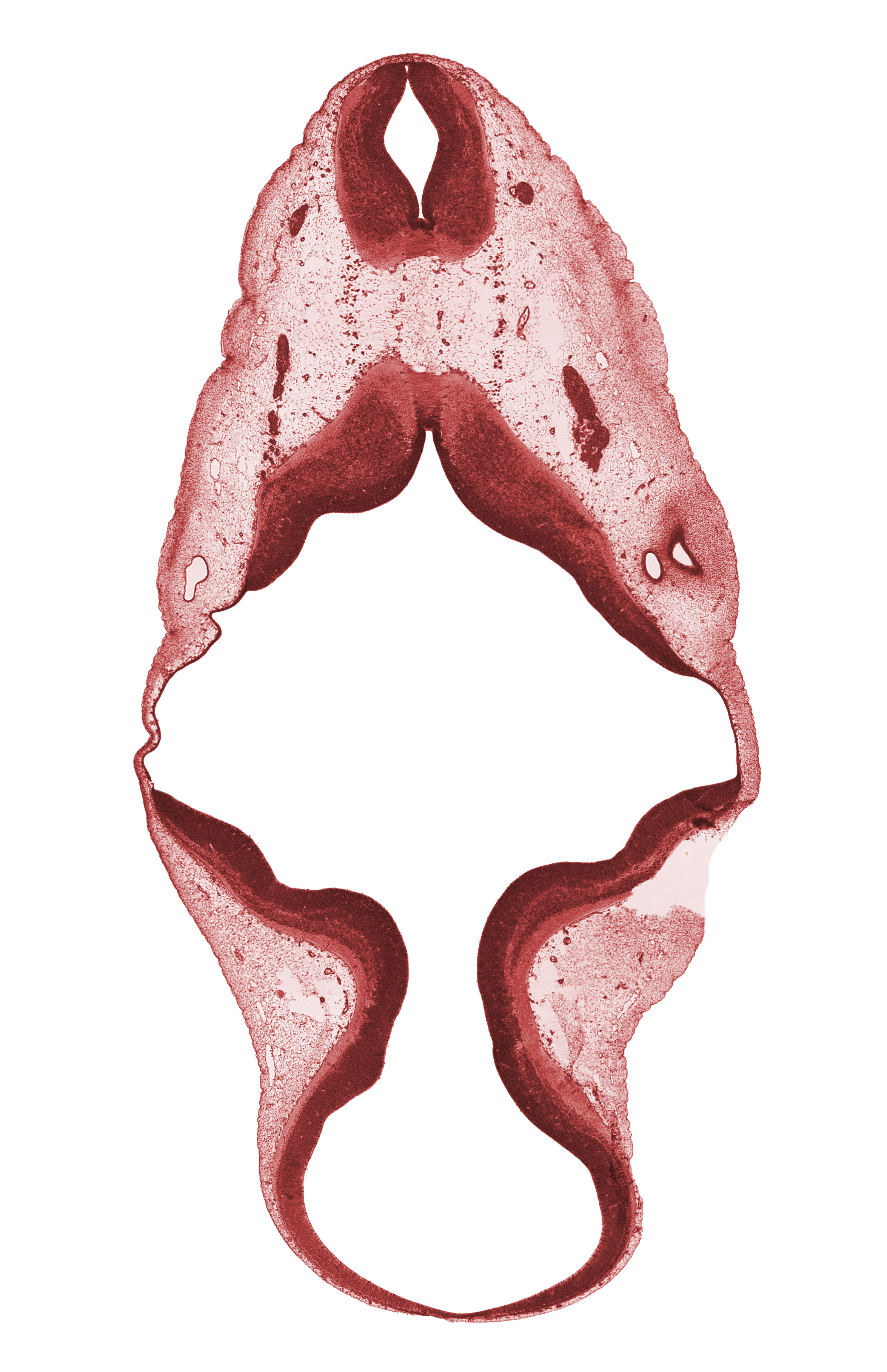 accessory nerve (CN XI), artifact(s), cephalic edge of C-1 spinal ganglion, junction of brain and spinal cord, mesencephalon (M2), mesencoel (cerebral aqueduct), region of cervical flexure, spinal accessory nerve (CN XI), sulcus limitans, trochlear nerve (CN IV), vagus nerve (CN X)