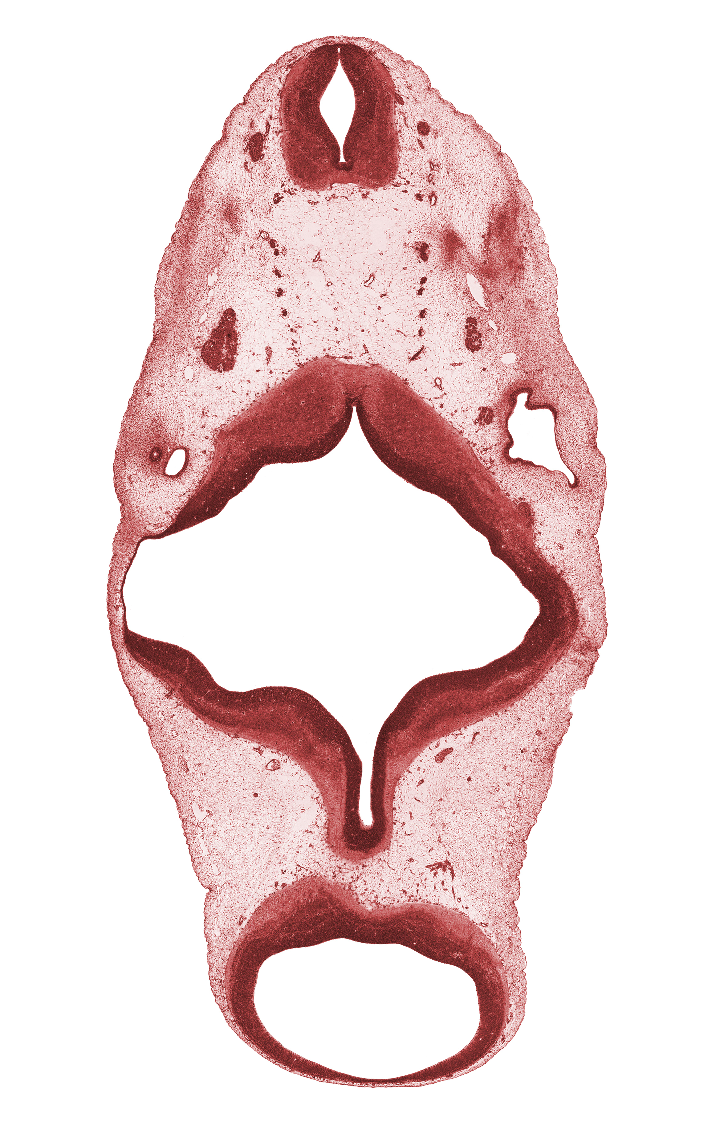 C-1 spinal ganglion, C-1 ventral root, cerebral peduncle, edge of anterior semicircular duct, junction of endolymphatic duct and vestibular part of otic vesicle, median sulcus, oculomotor nerve (CN III), rhombencoel (fourth ventricle), rhombomere 4, root of hypoglossal nerve (CN XII), trochlear nerve (CN IV), vertebral artery