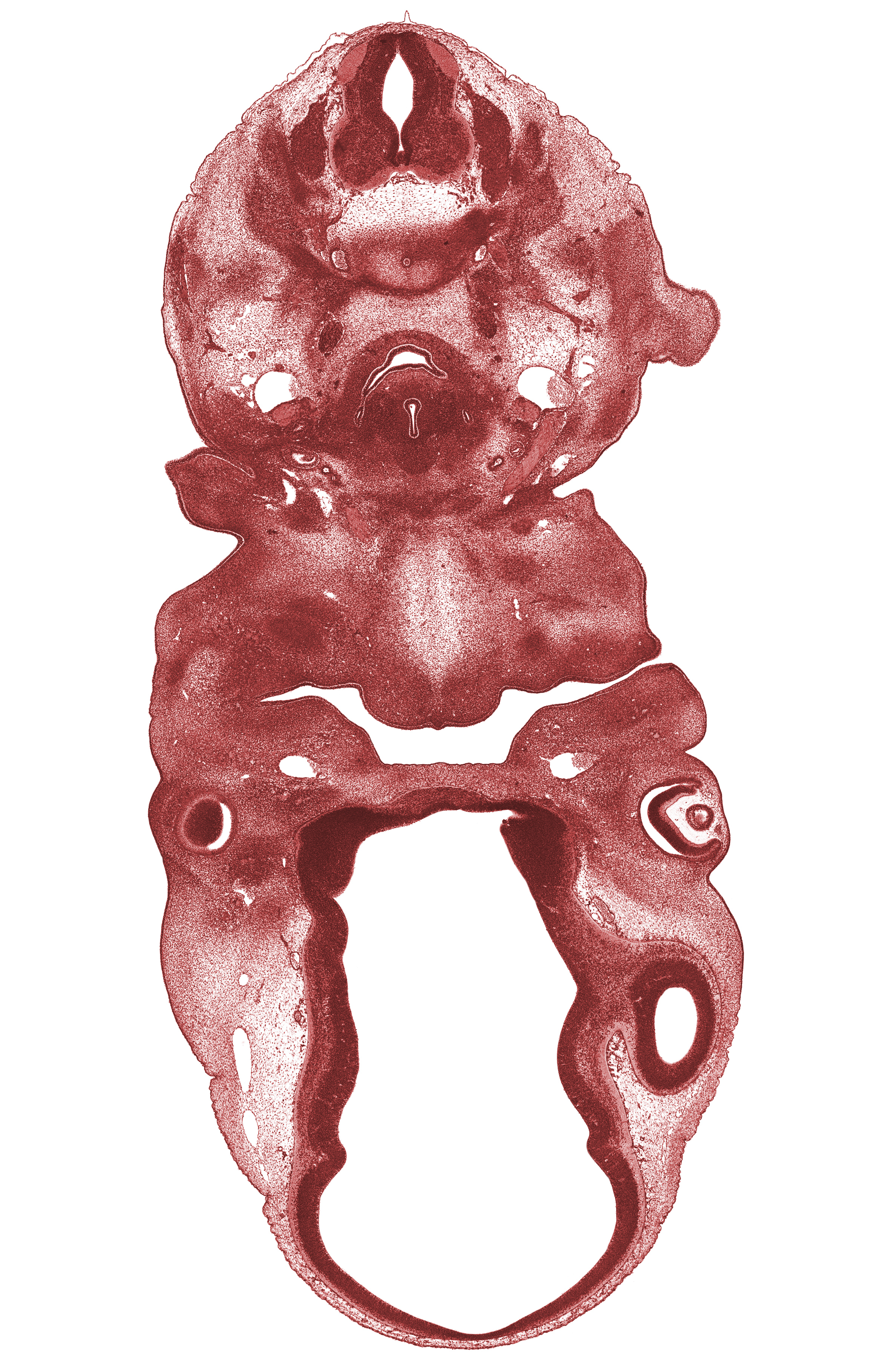 C-6 spinal ganglion, angle of mouth, dorsal thalamus, edge of lateral ventricle, edge of shoulder, external layer of retina, hypoglossal nerve (CN XII), inferior parathyroid gland, isthmus of thyroid gland, junction of external and internal carotid arteries, laryngeal condensation, laryngeal pharynx, lens vesicle cavity, marginal ridge, optic chiasma (chiasmatic plate), optic sulcus, oronasal cavity, precardinal vein, ventral thalamus, vitreous cavity