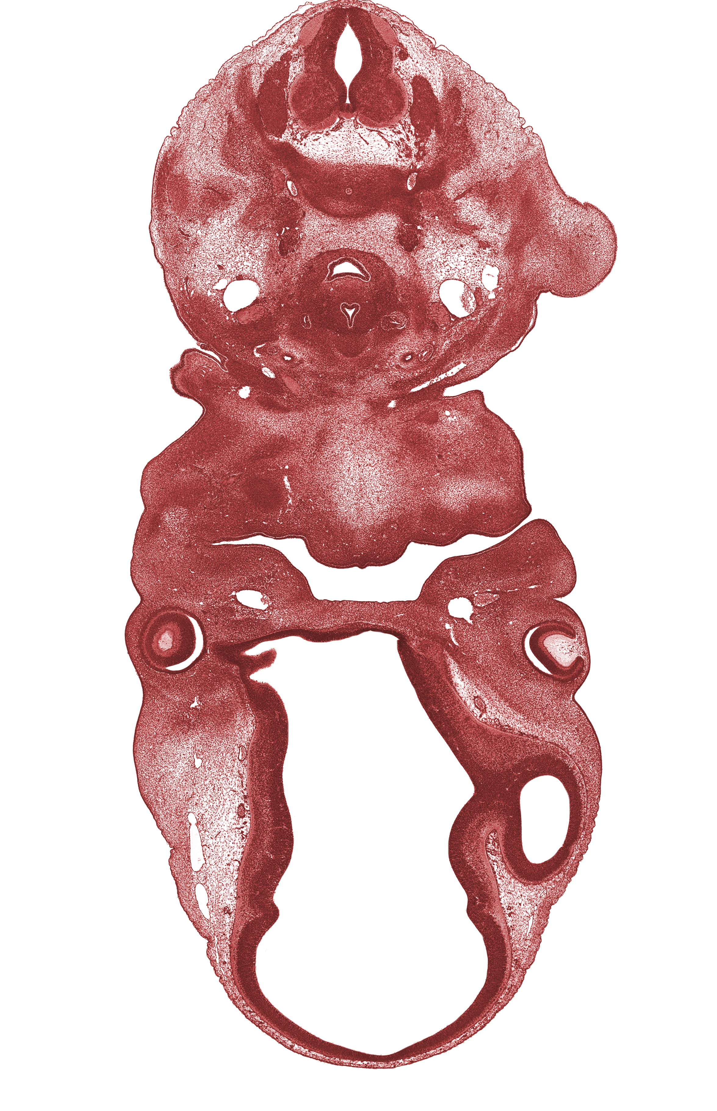 C-7 spinal ganglion, auricular hillock, buccal region, dorsal fasciculus, external jugular vein, intraretinal space (optic vesicle cavity), laryngeal pharynx, lens vesicle, marginal ridge, neural layer of retina, notochord, optic chiasma (chiasmatic plate), optic cup cavity, optic sulcus, phrenic nerve, pigmented layer of retina, precardinal vein (internal jugular vein), precartilage condensation of pharyngeal arch 2, sympathetic trunk, thymus gland, thyroid gland, vascular plexus