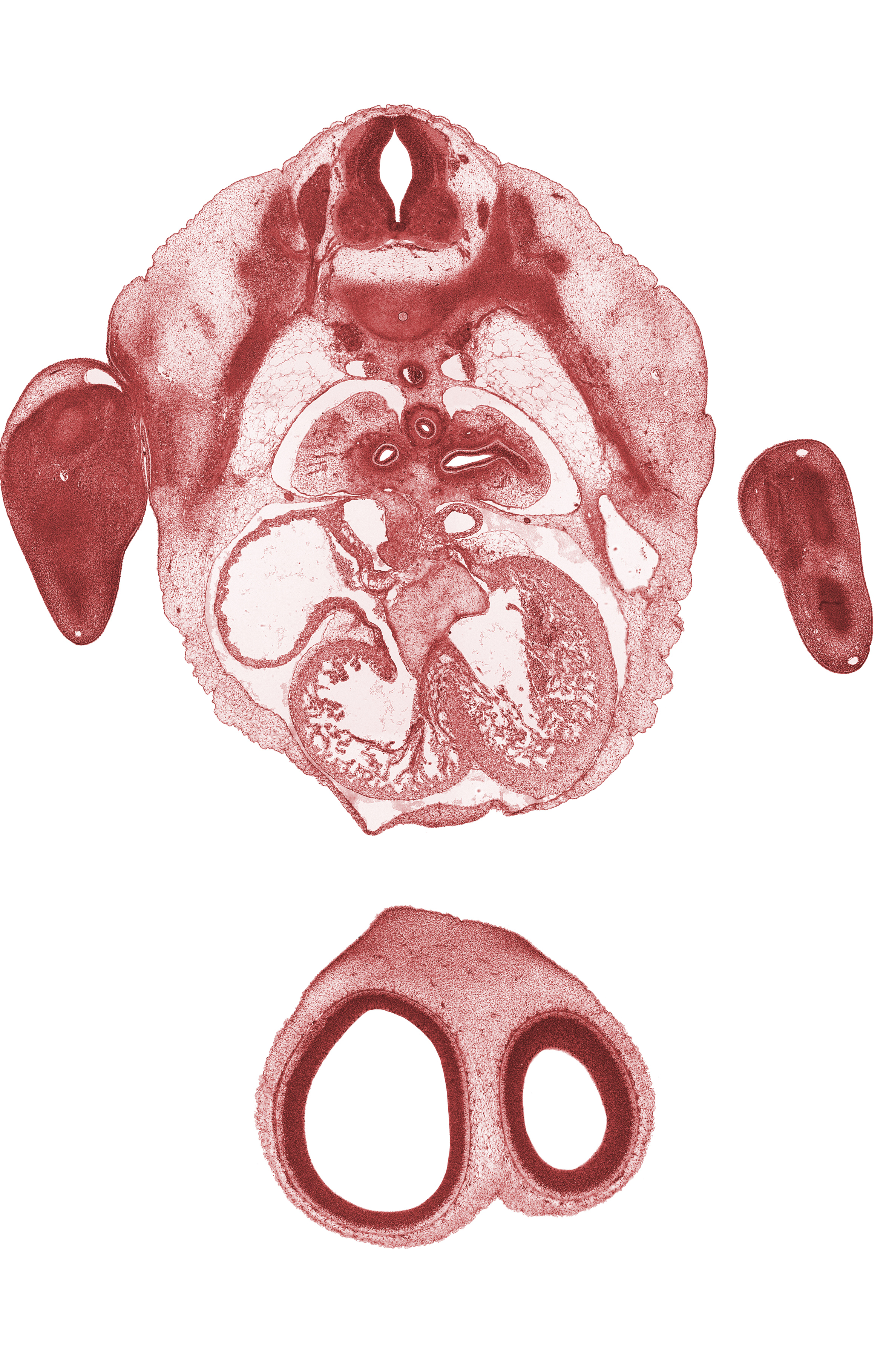 T-3 / T-4 interganglion region, aorta, atrioventricular endocardial cushion(s), frontal prominence, interventricular sulcus, junction of atrioventricular endocardial cushion and interventricular septum, left horn of sinus venosus, left ventricle, musculi pectinati in right atrial wall, peritoneal cavity, postcardinal vein, pulmogenic coat, right atrioventricular canal, right ventricle, sinus venosus, sympathetic trunk