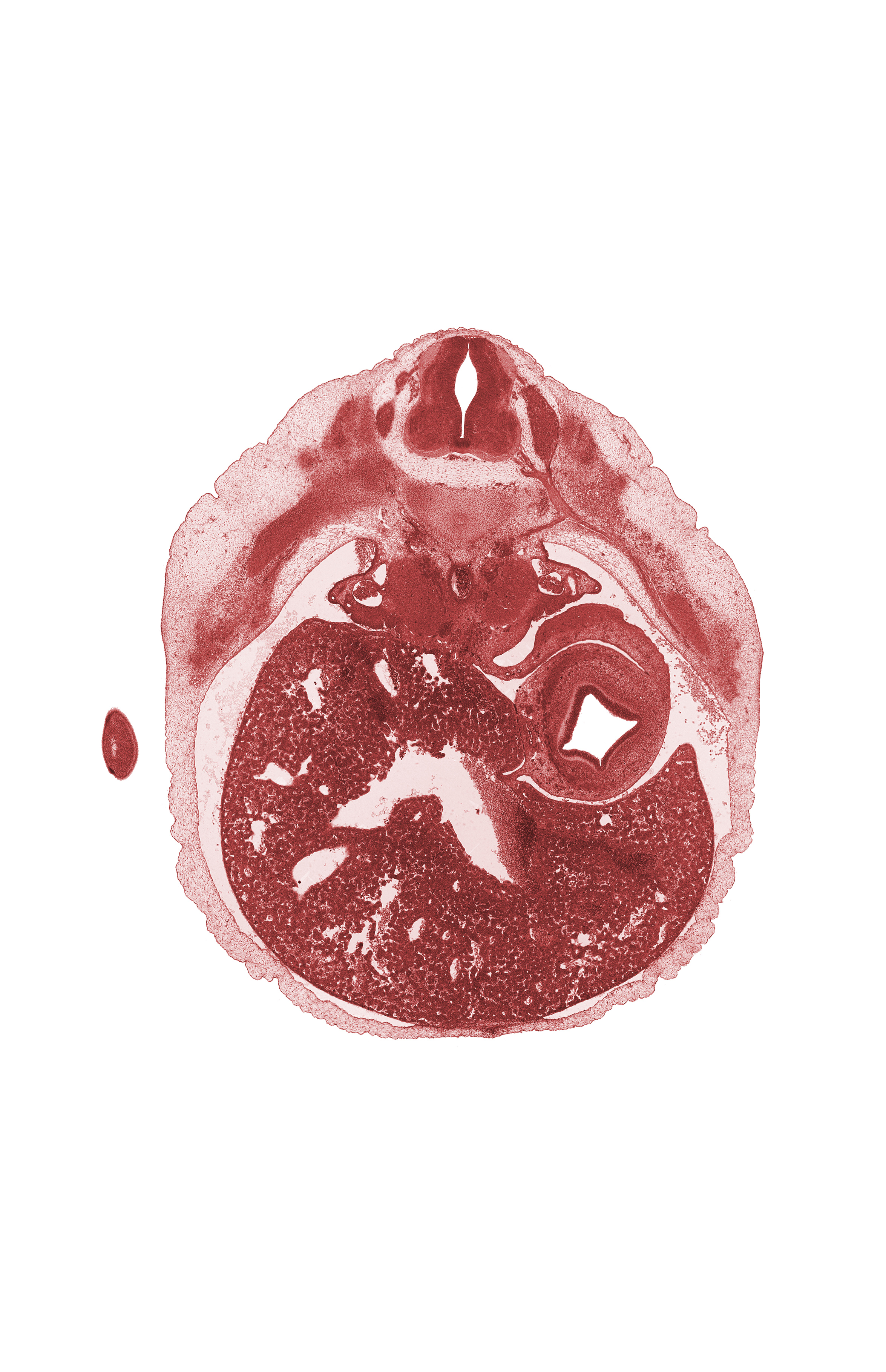 T-8 intercostal nerve, T-8 spinal ganglion, T-8 spinal nerve, afferent hepatic vein, anterior abdominal wall, aorta, caudal edge of mammary gland, caudal end of upper limb, communicating ramus, dorsal mesogastrium, ductus venosus, hepatic sinusoid, loose cephalic part of sclerotome, spleen, ventral mesogastrium (lesser omentum)