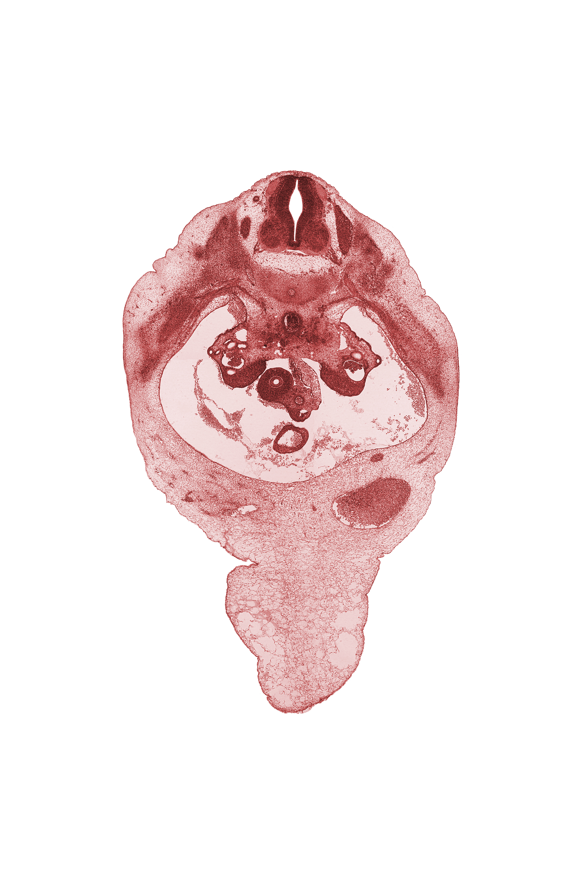 T-11 spinal ganglion, aorta, communicating ramus, duodenum, gonadal ridge, mesonephric duct, mesonephros, postcardinal vein, superior mesenteric artery, superior mesenteric vein, sympathetic trunk, umbilical cord, umbilical vein