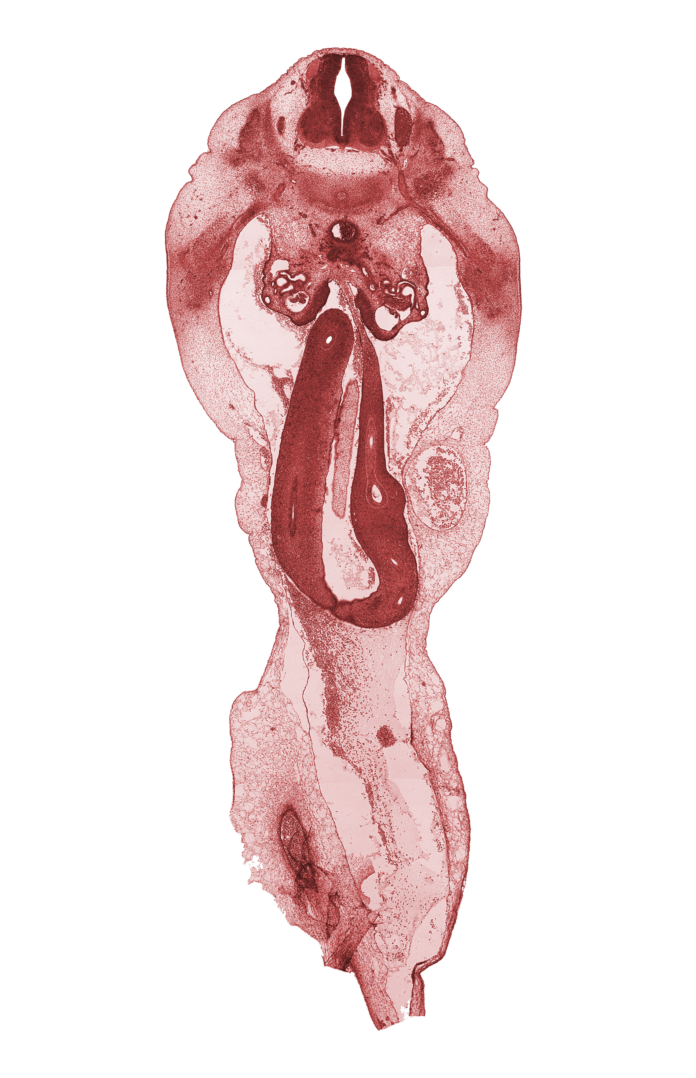 L-1 spinal ganglion, L-1 spinal nerve, aorta, caudal edge of superior mesenteric artery, cecum, distal limb of herniated midgut, duodenum, mesenchyme in mesentery of herniated midgut, mesonephric vesicle(s), proximal limb of herniated midgut, umbilical coelom, umbilical vein