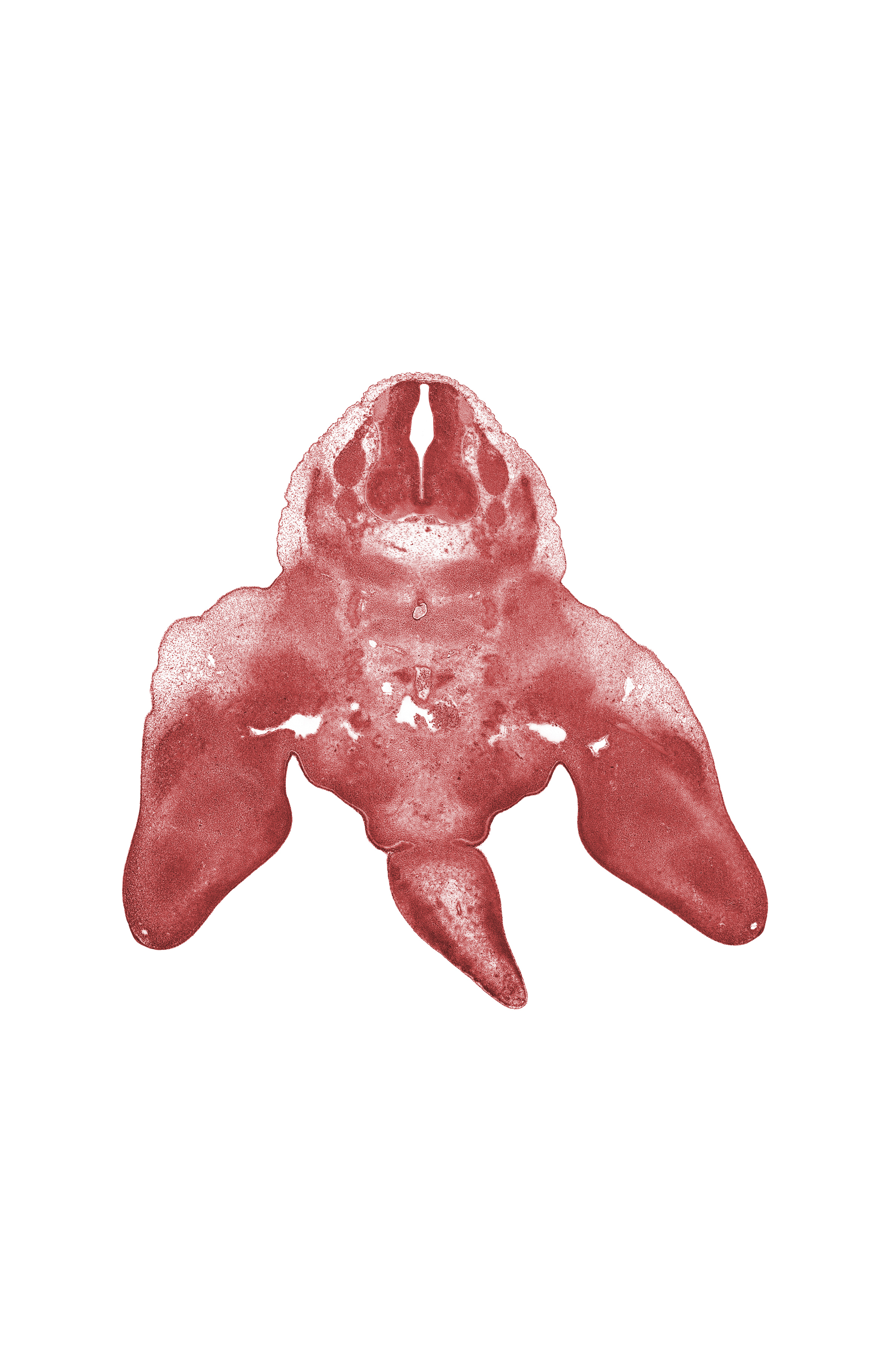 L-4 dorsal root, L-4 spinal ganglion, L-5 spinal ganglion, L-5 spinal nerve, caudal eminence, notochord, pelvic plexus, sympathetic trunk