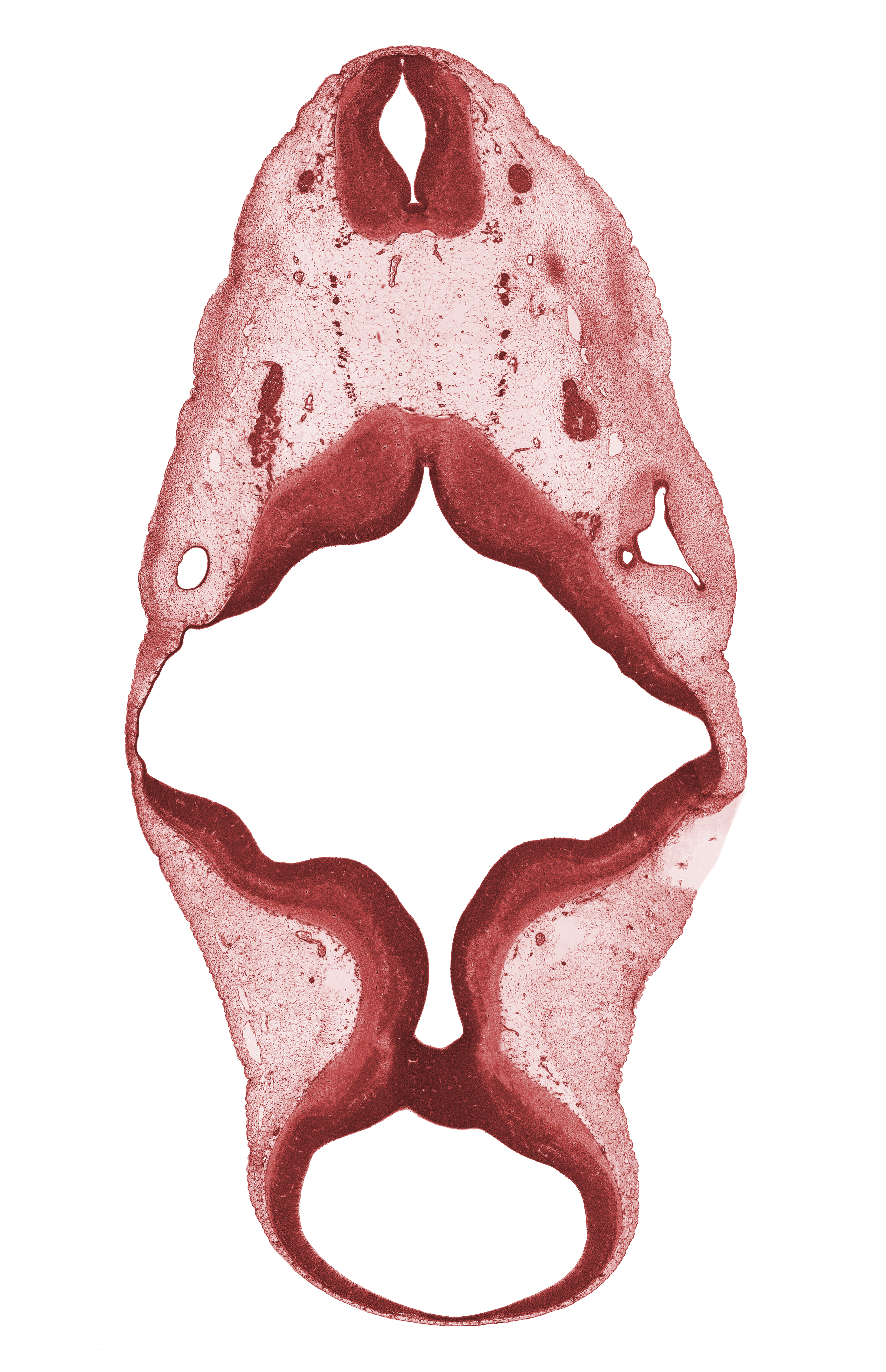 C-1 spinal ganglion, C-1 ventral root, accessory nerve (CN XI), alar plate of metencephalon (cerebellum), alar plate(s), basal plate, missing tissue (artifact), oculomotor nerve (CN III), rhombomere 5, roof plate, roof plate of rhombencephalon, root of glossopharyngeal nerve (CN IX), sulcus limitans, superior ganglion of vagus nerve (CN X), trochlear nerve (CN IV), vertebral artery