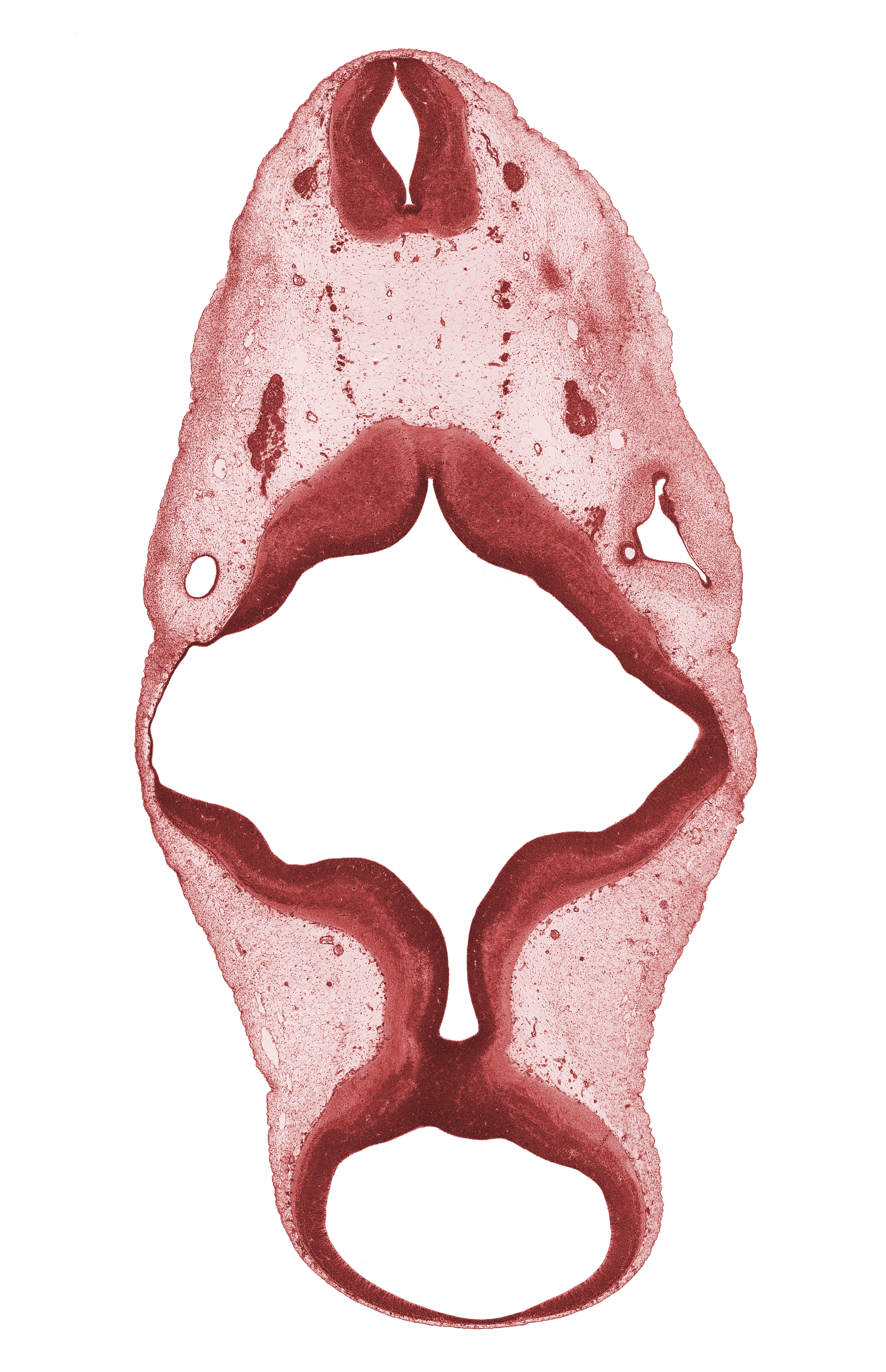 C-1 spinal ganglion, C-1 ventral root, endolymphatic duct, median sulcus, mesencoel (cerebral aqueduct), rhombomere 4, root of hypoglossal nerve (CN XII), trochlear nerve (CN IV), vagus nerve (CN X)