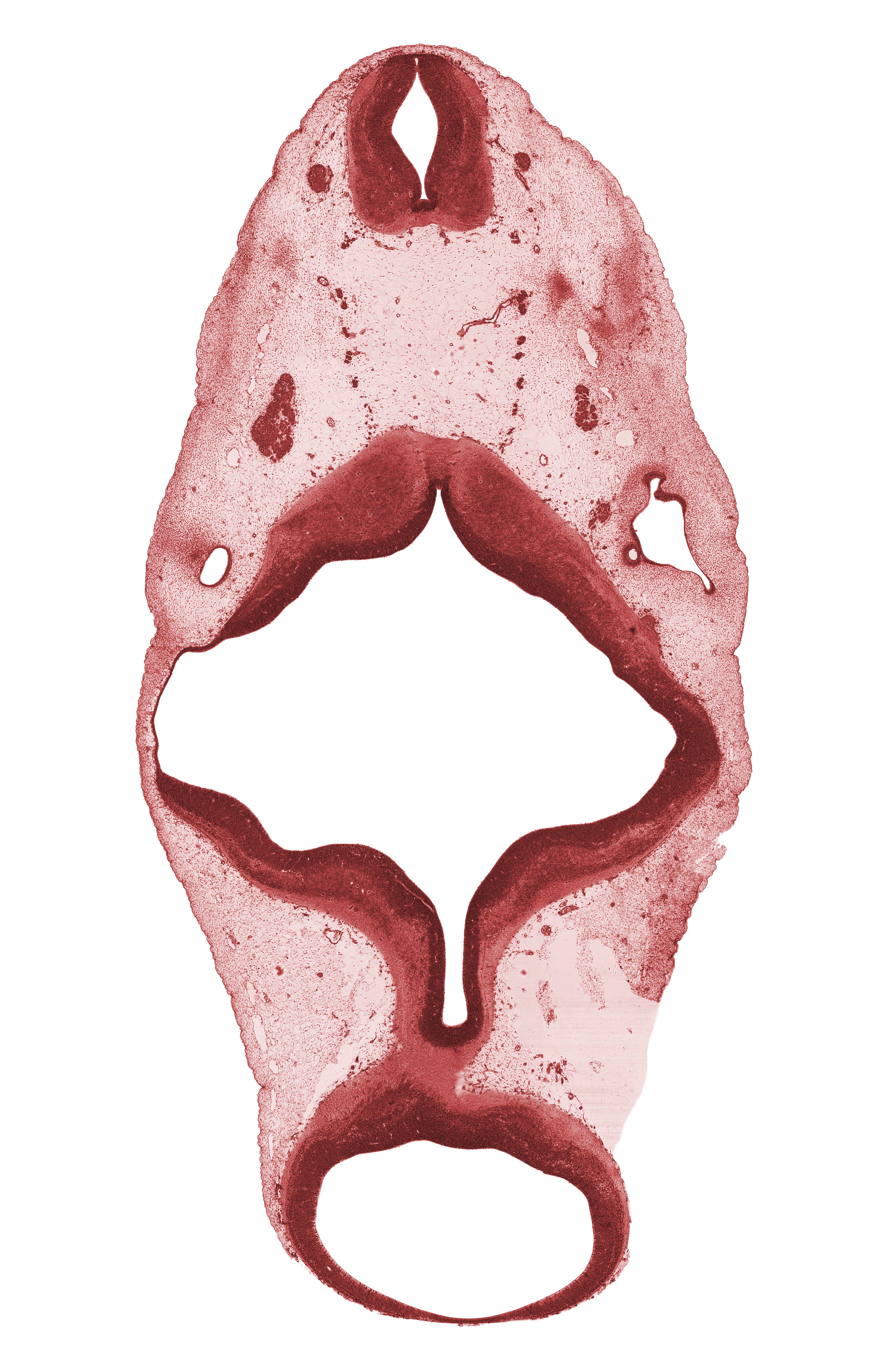 C-1 spinal ganglion, C-1 ventral root, accessory nerve (CN XI), edge of otic capsule condensation, edge of root of vestibulocochlear nerve (CN VIII), glossopharyngeal nerve (CN IX), missing tissue (artifact), roof plate of rhombencephalon, root of hypoglossal nerve (CN XII), spinal accessory nerve (CN XI), vagus nerve (CN X), vertebral artery