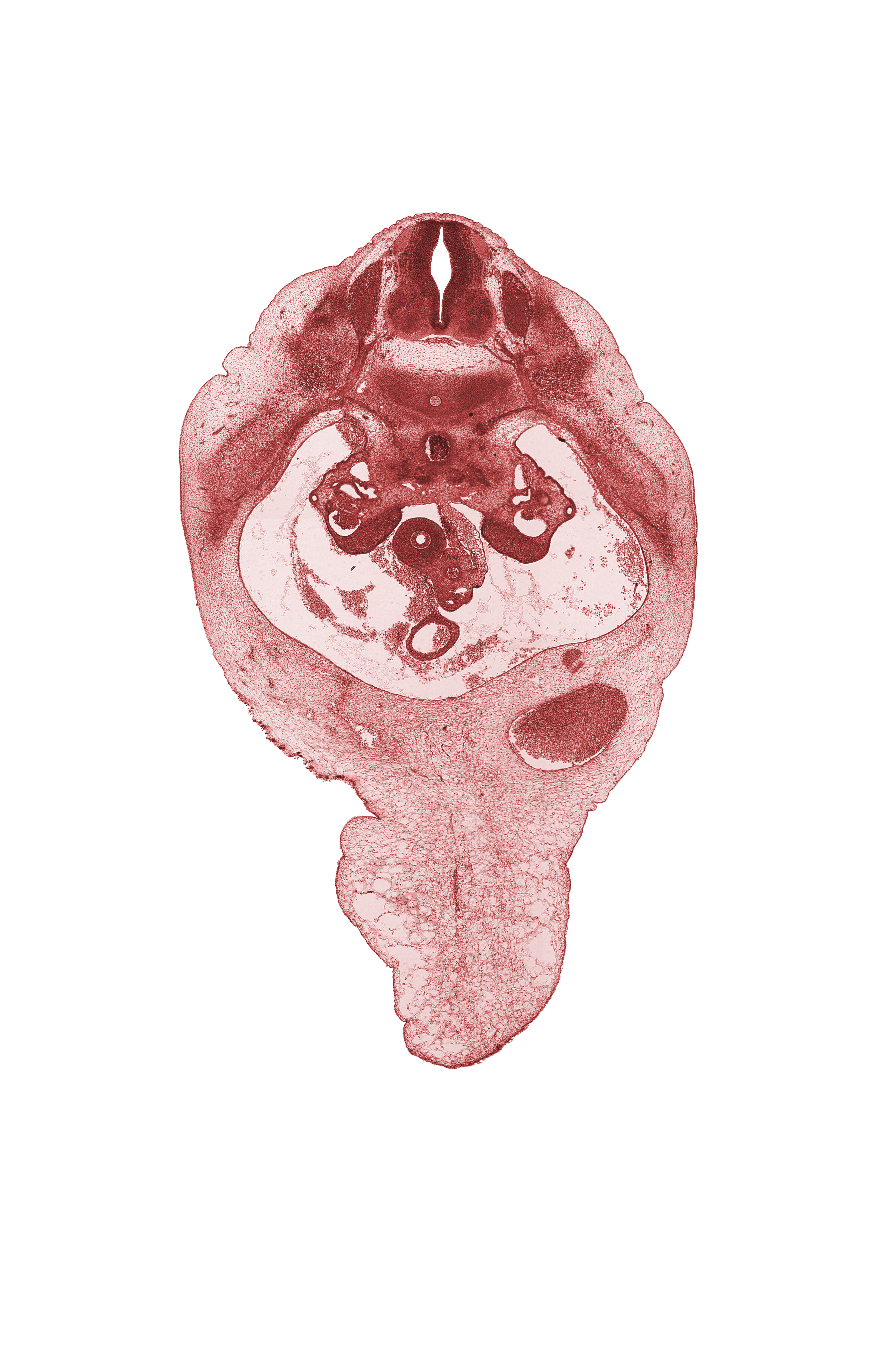 T-11 intercostal nerve, T-11 spinal ganglion, T-11 spinal nerve, alar plate(s), basal plate, duodenum, floor plate, meninx, mucoid connective tissue, notochord, roof plate, sulcus limitans, superior mesenteric artery, superior mesenteric vein, umbilical cord, umbilical vein